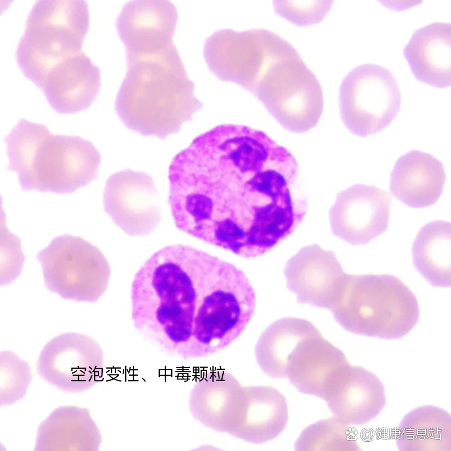 中毒颗粒 全网资源
