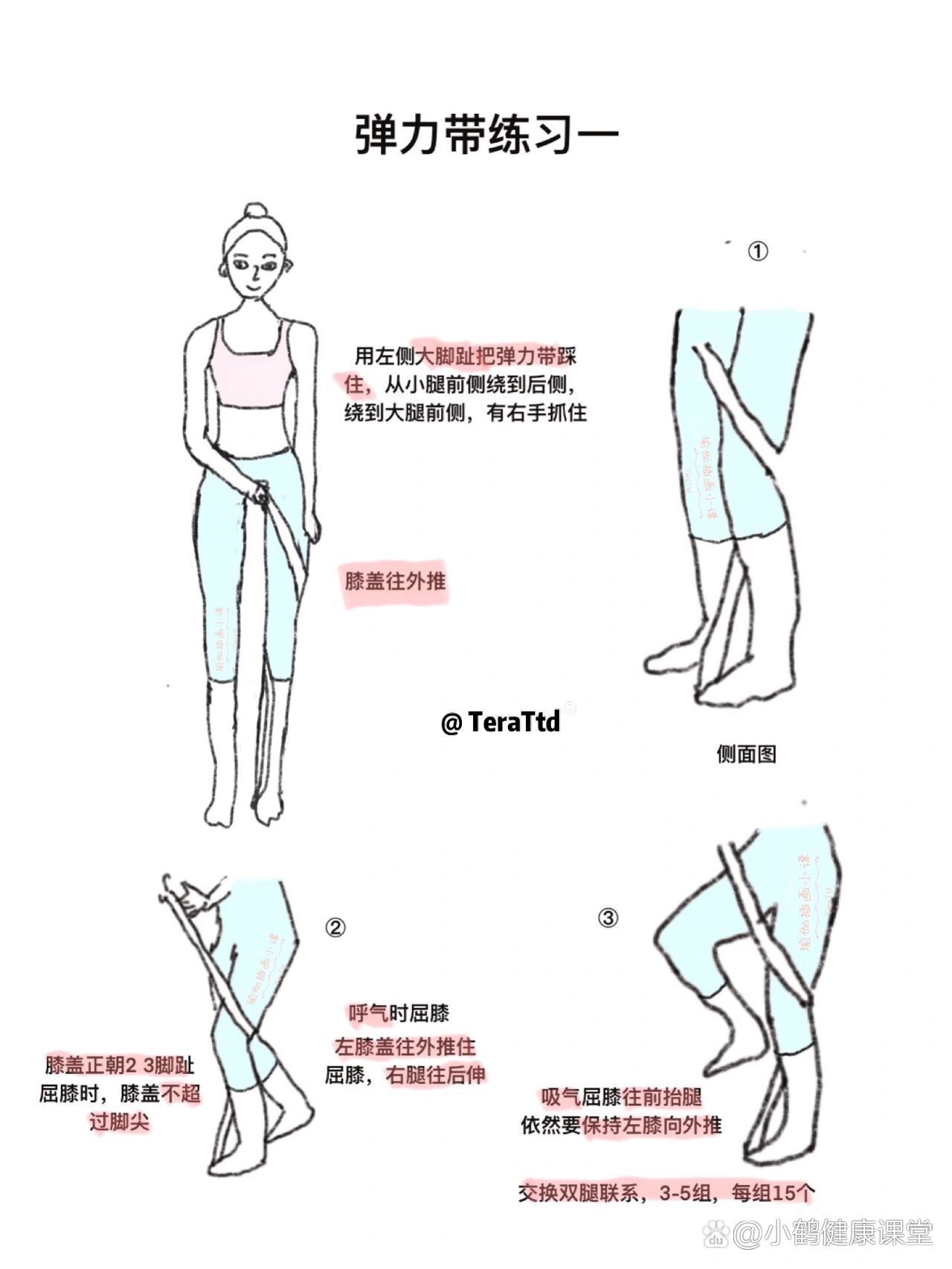 一张图带你认识x型腿|附矫正训练,弹力带