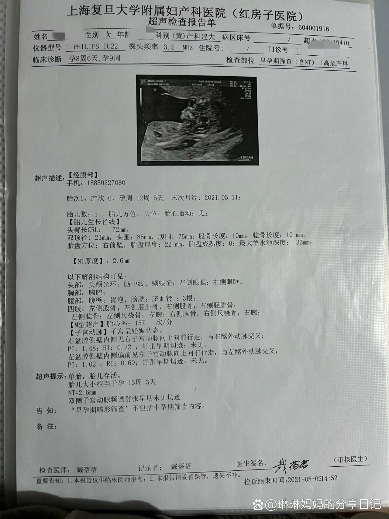  p>#******红房子产检记录:红房子羊水穿刺记录 br>2021年8月9日,孕12