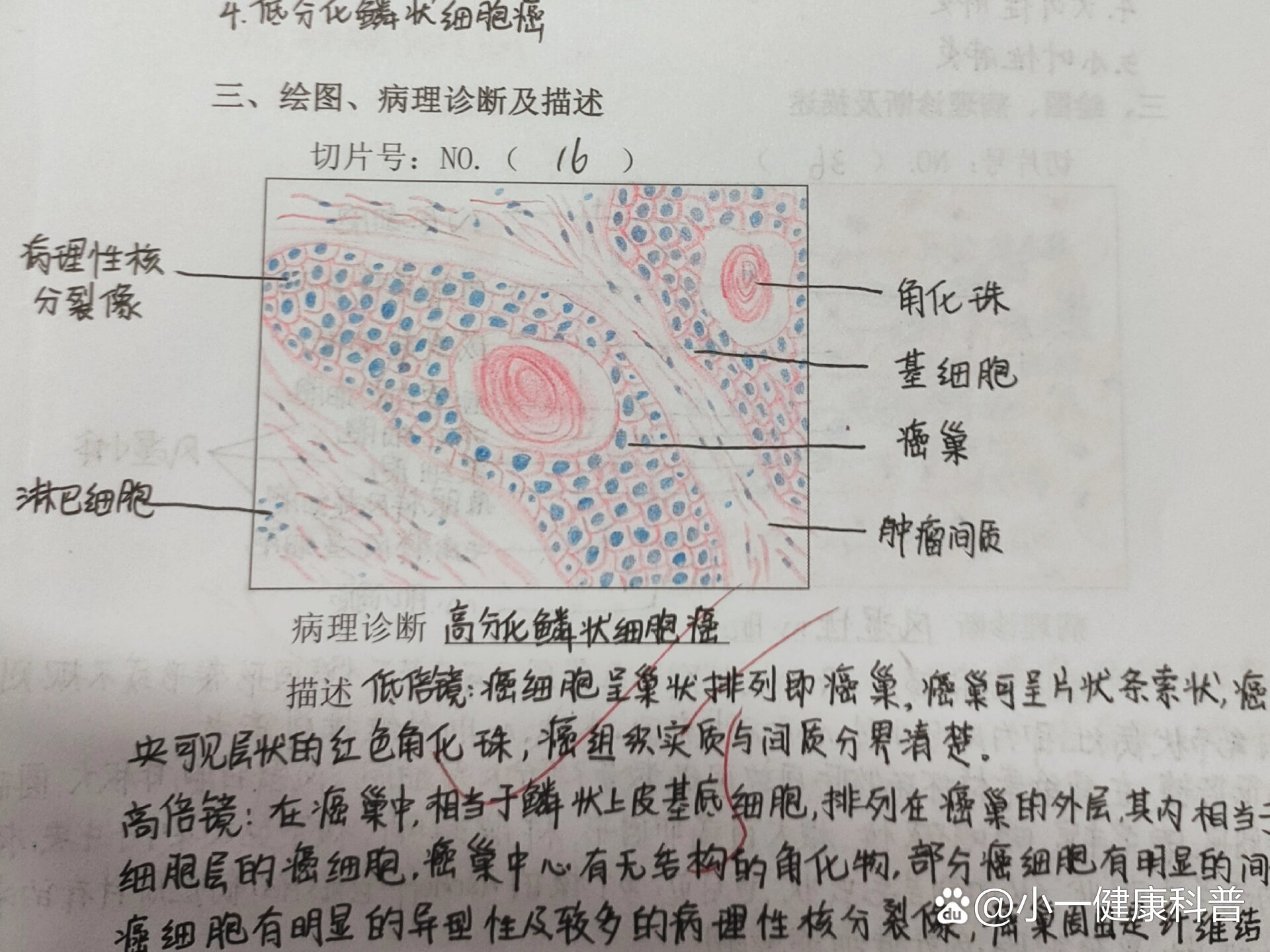 绒癌红蓝铅笔图图片