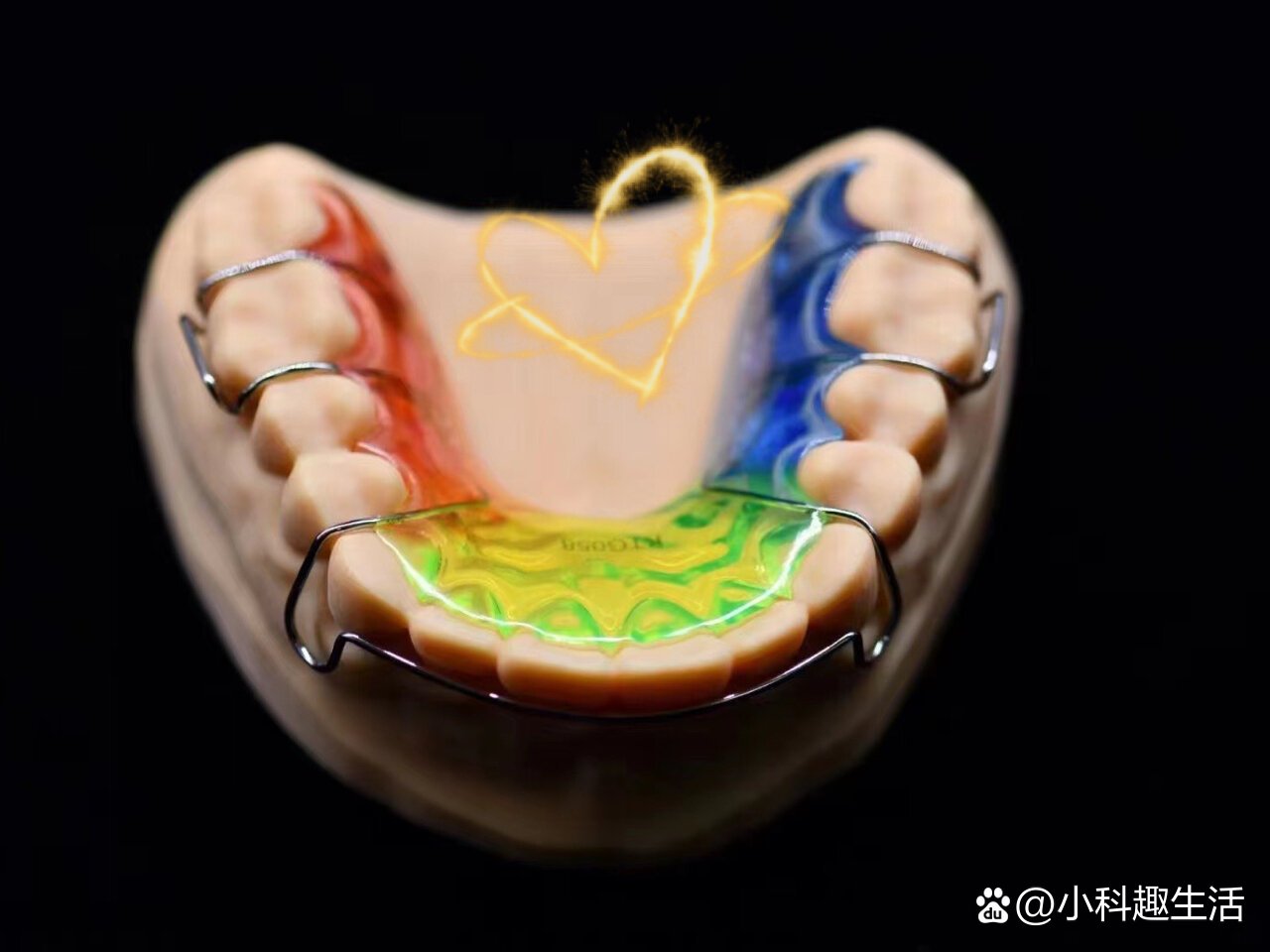 上颌平面导板制作图片