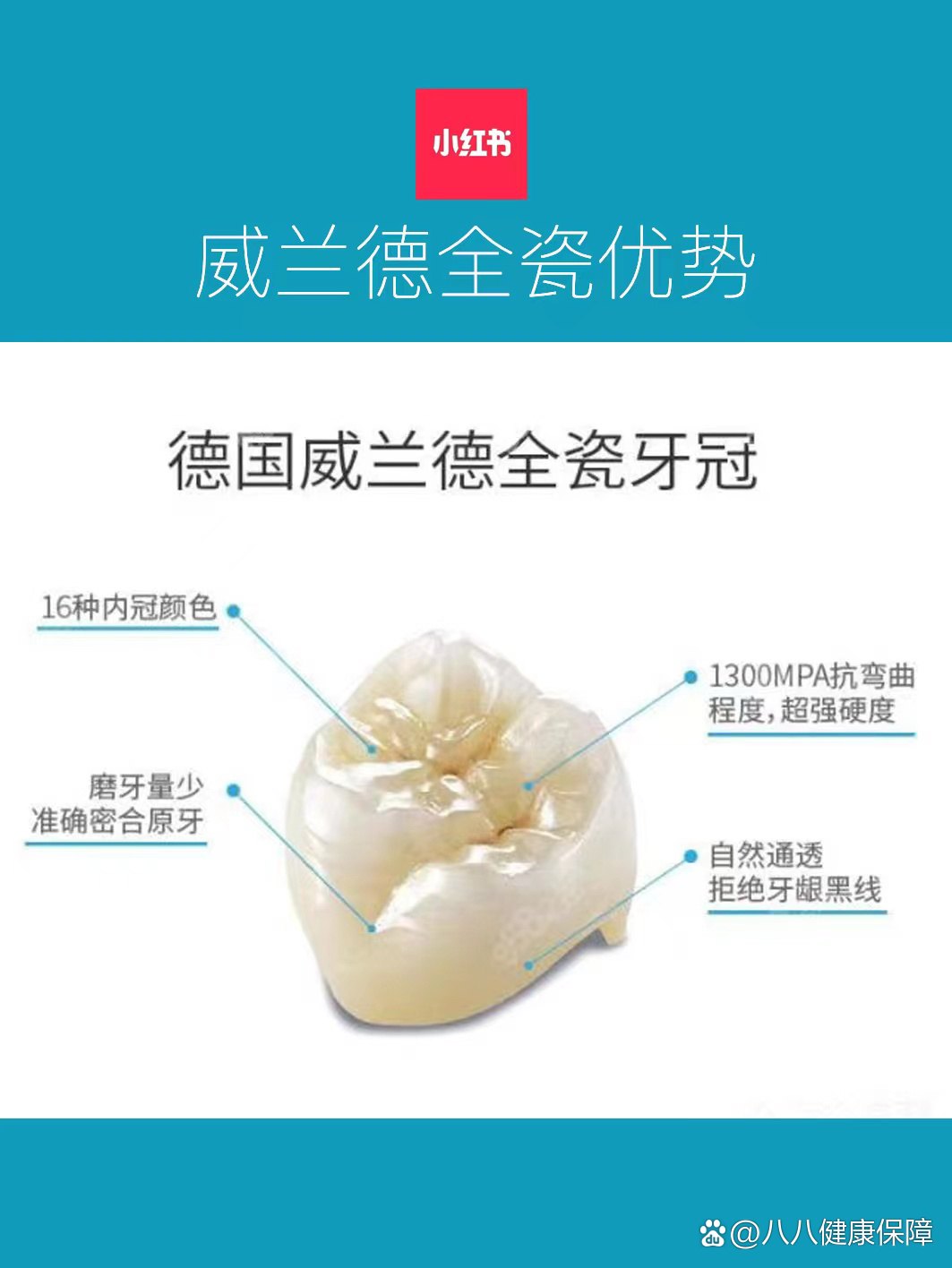 德国进口威兰德全瓷牙深度解析