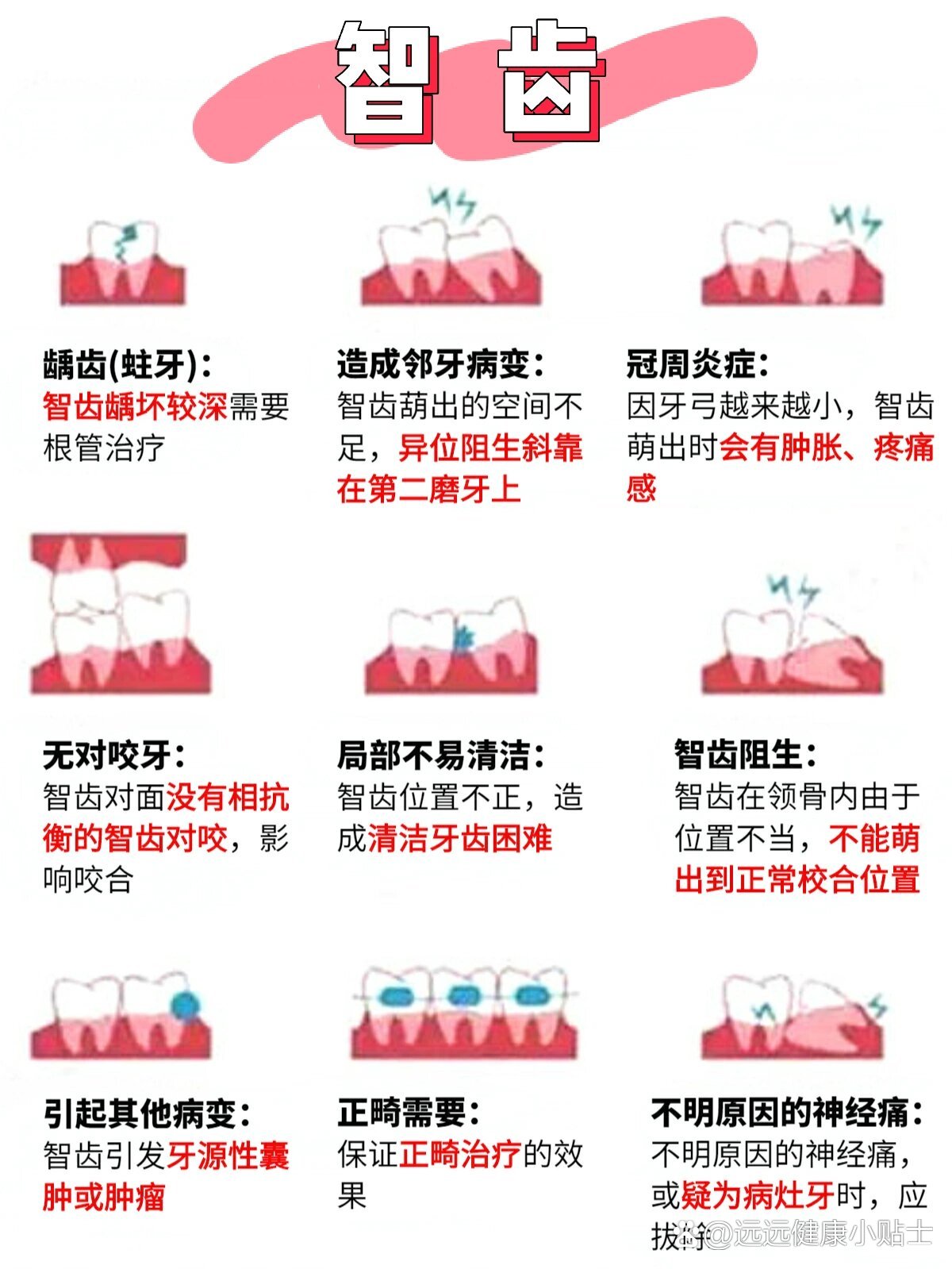 拔智齿的年龄一般是多少岁?