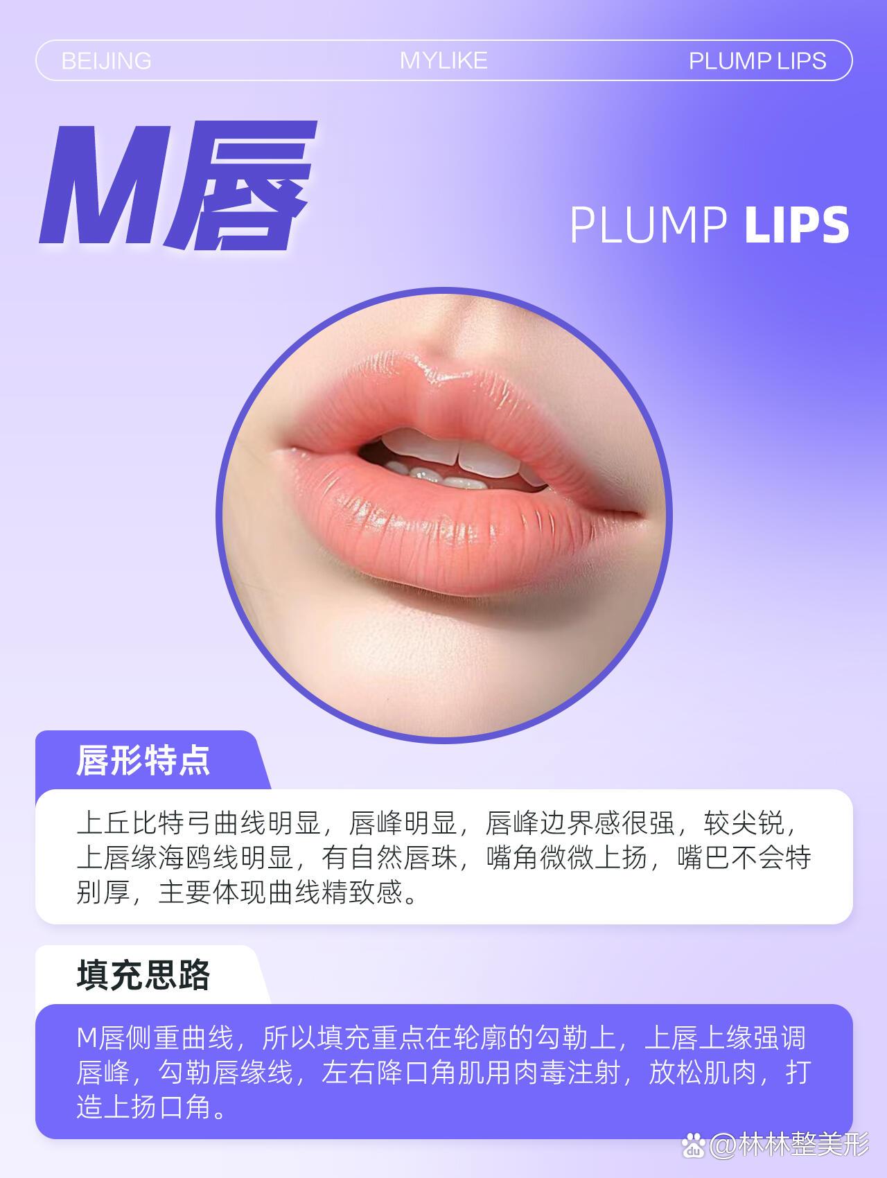 唇峰明显,唇峰边界感很强,较尖锐,上唇缘海鸥线明显,有自然唇珠