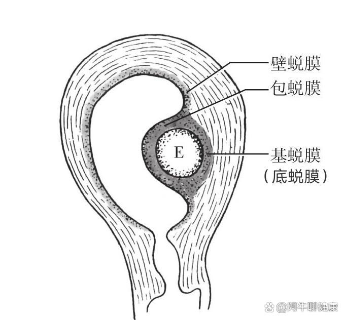 羊膜囊与绒毛膜囊图片图片