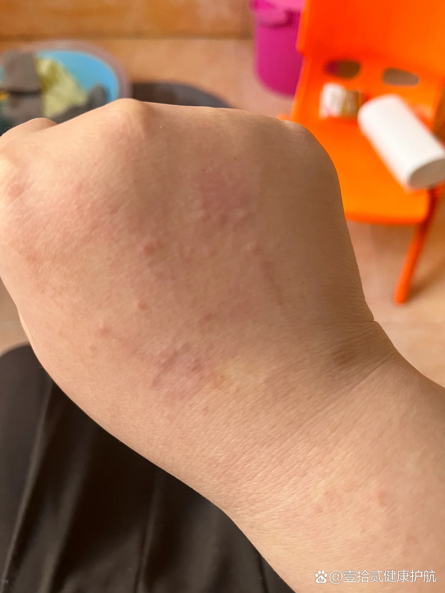 用完欧舒丹沐浴露后就过敏了