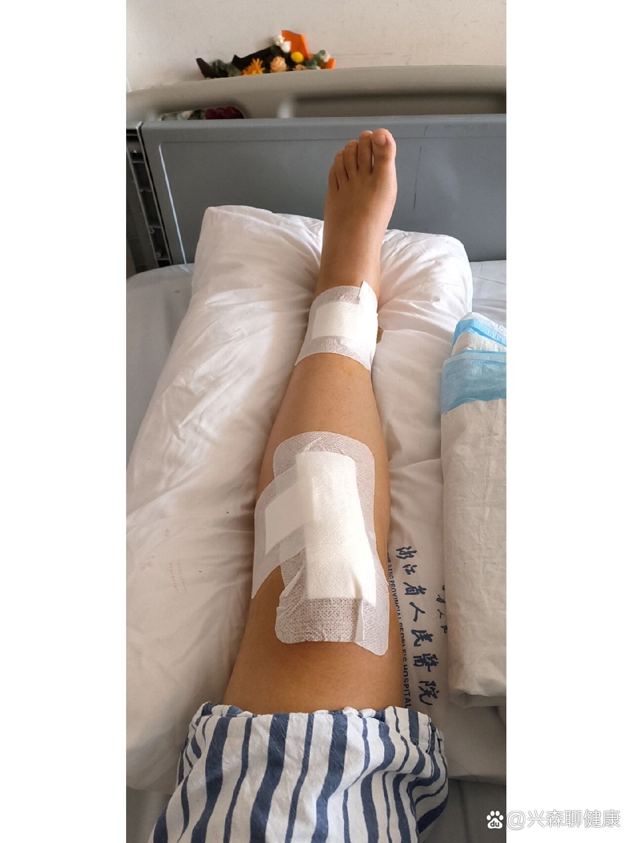 小腿胫骨骨折