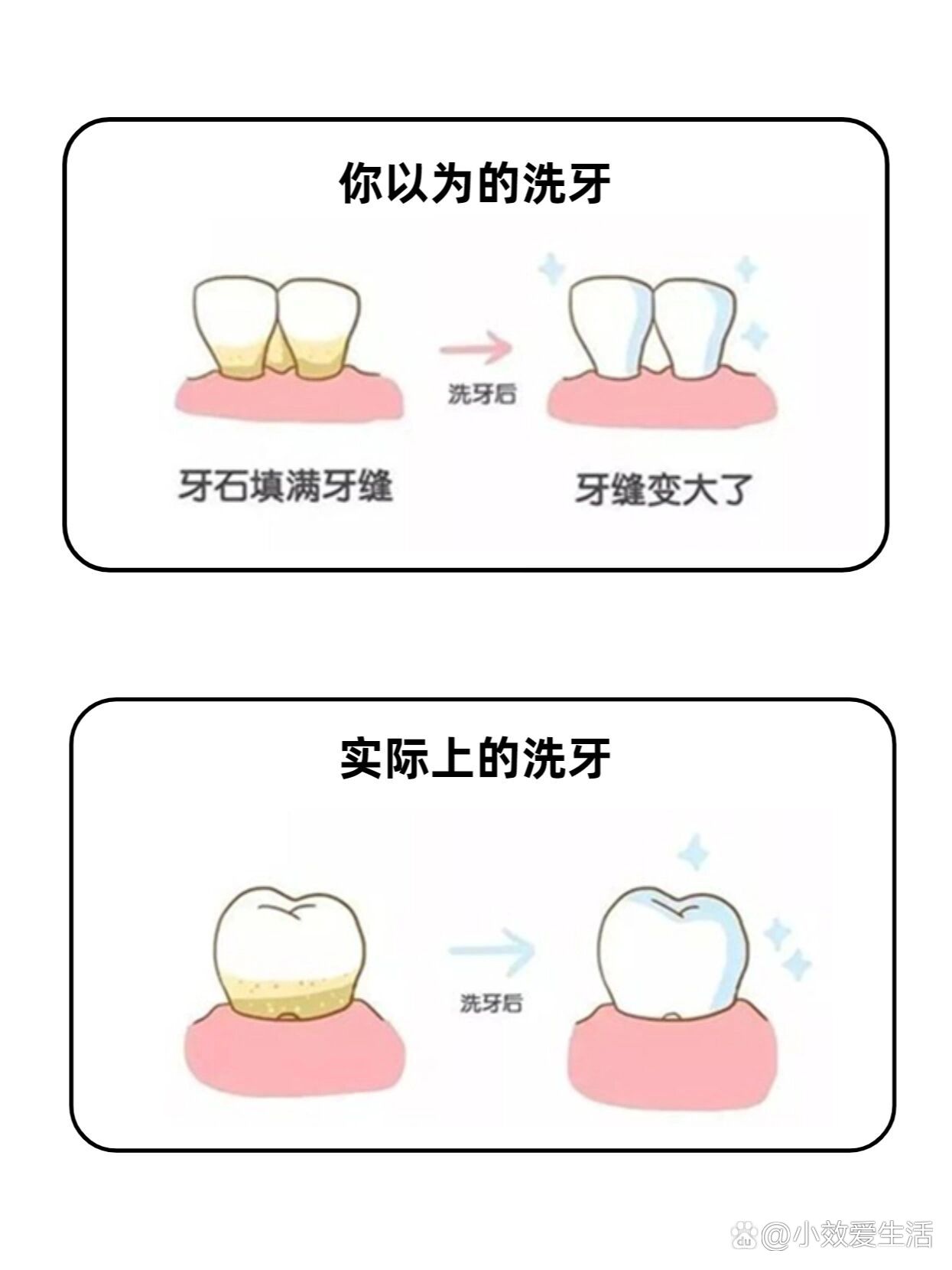 洗牙的危害图片