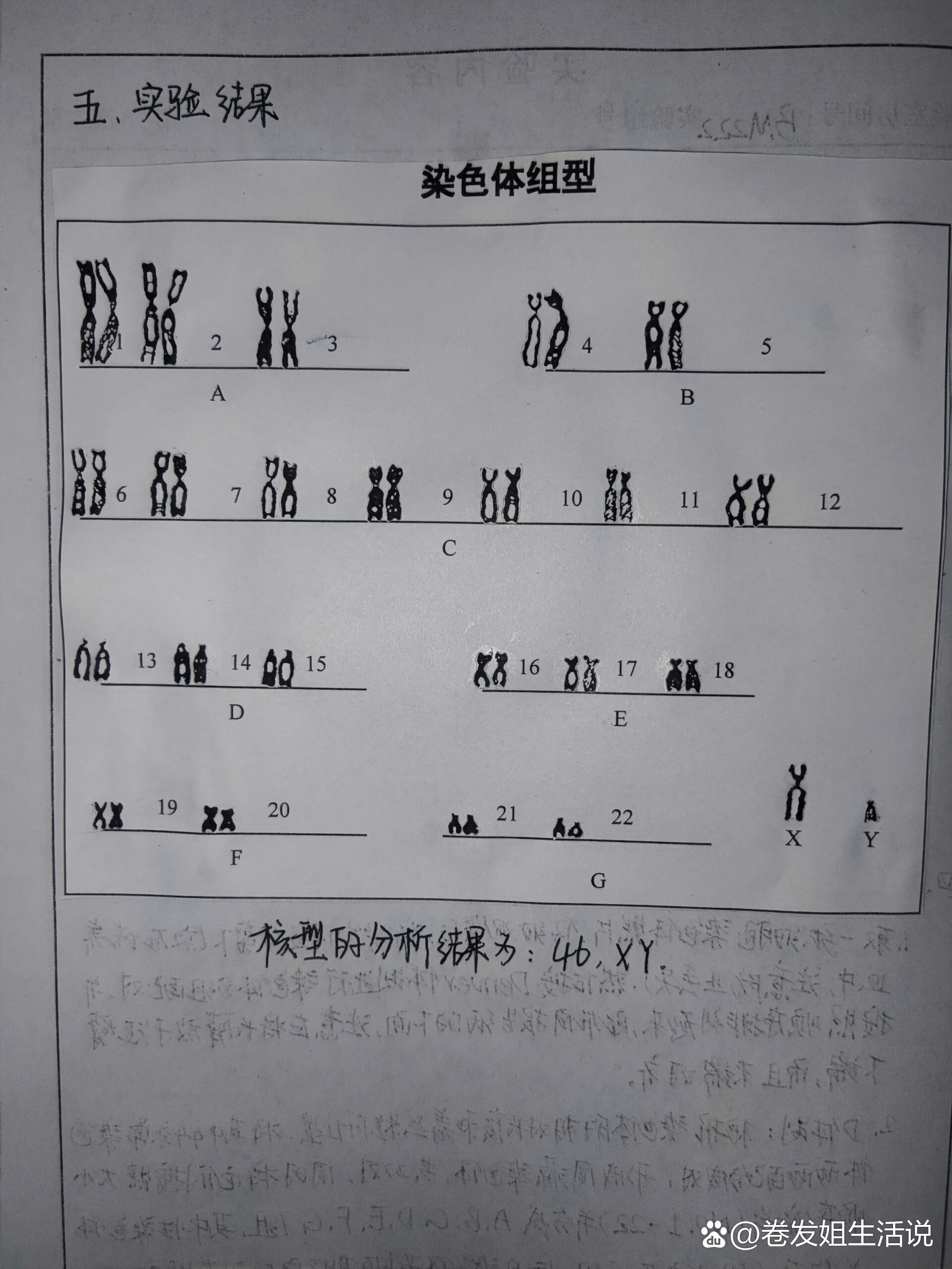 染色体的组成成分图片