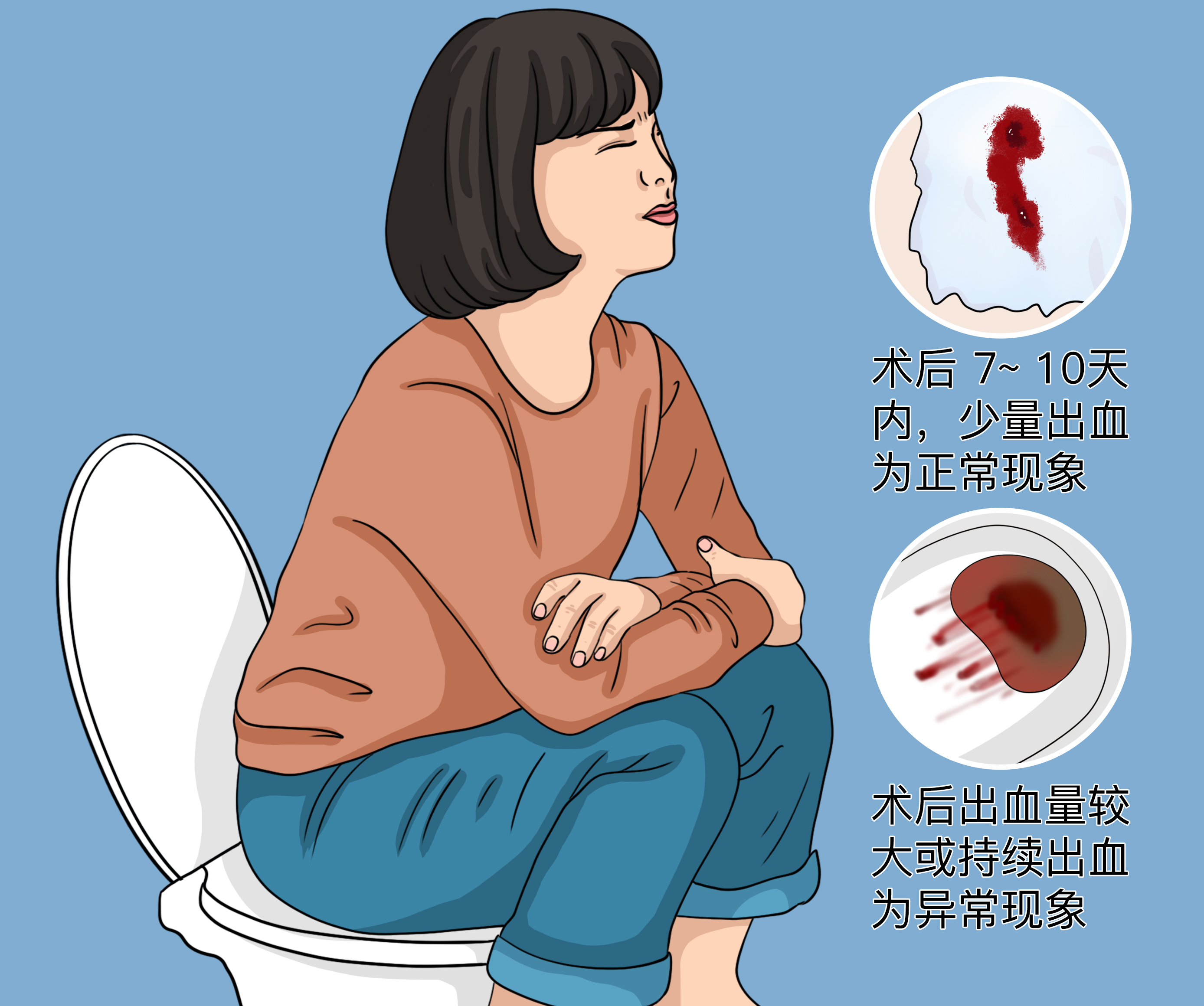 痔疮手术后大便出血正常吗