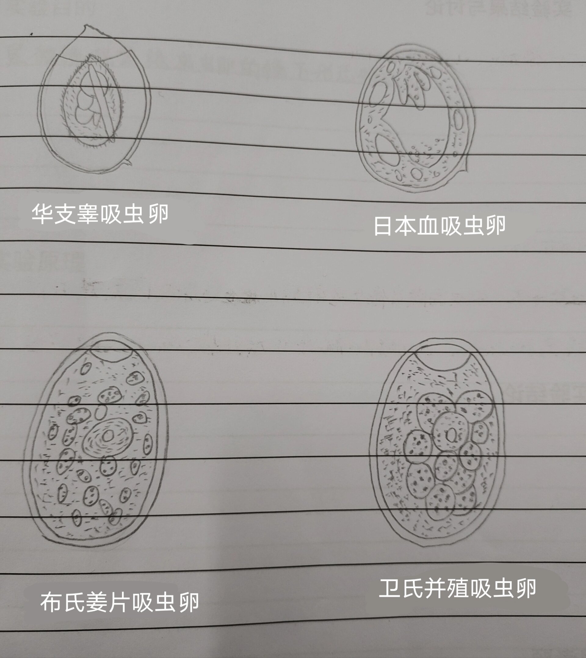 鞭虫卵手绘图及名称图片