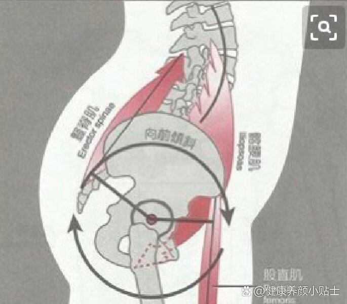 下交叉综合症矫正图解图片