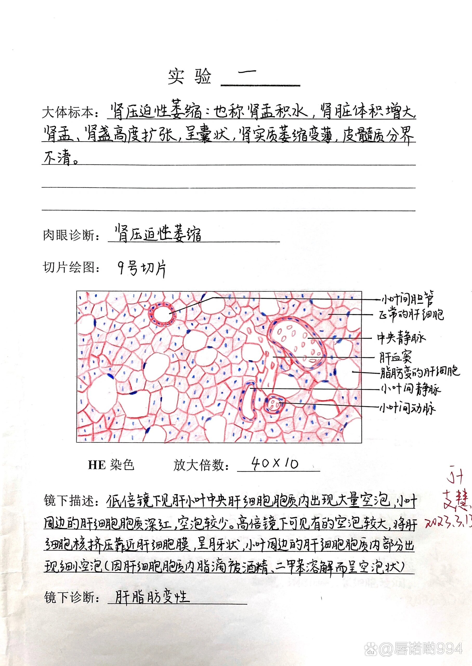 病理实验报告☀️当时给保留了下来 br>    br>p1  肝脂肪变性 br