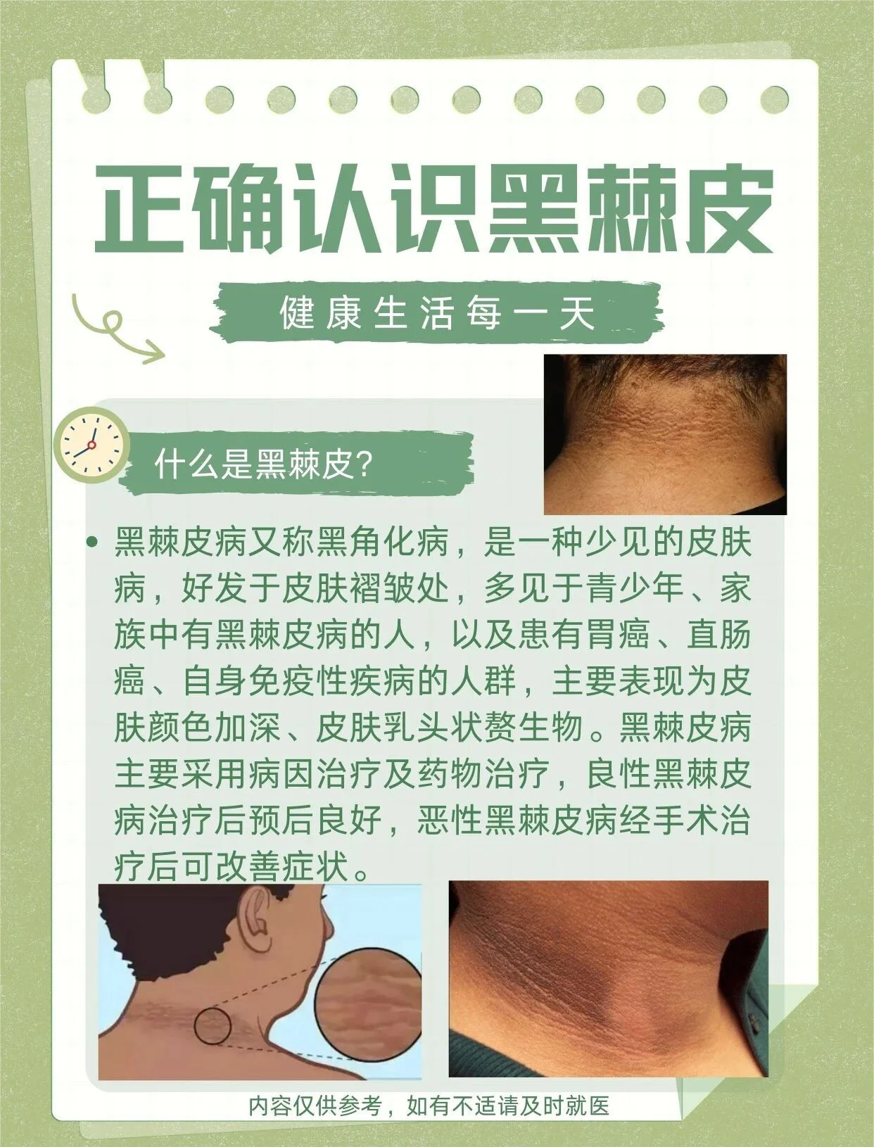 告别黑棘皮，肌肤焕新颜！