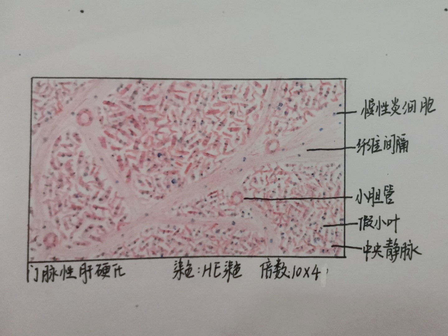 槟榔肝内可见图片