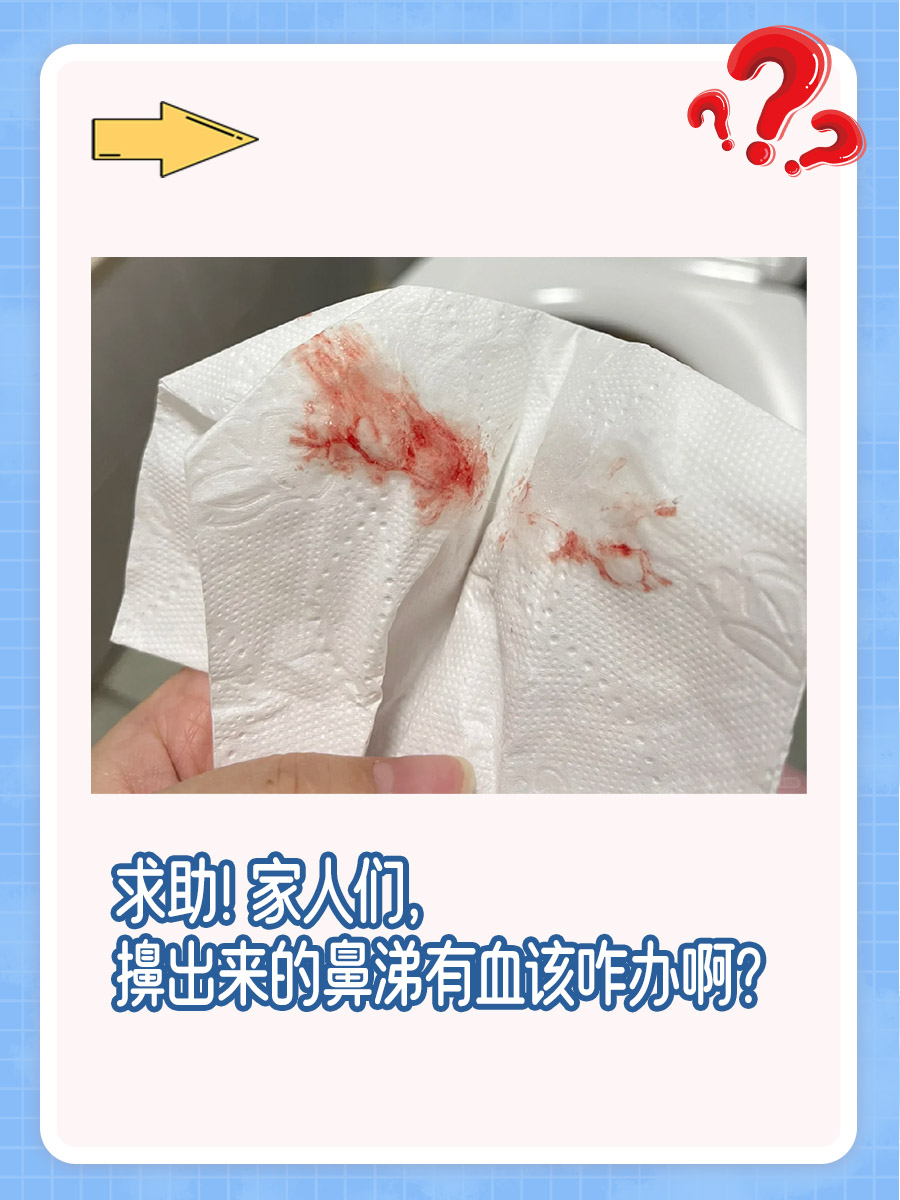 求助!家人们,擤出来的鼻涕有血该咋办啊?