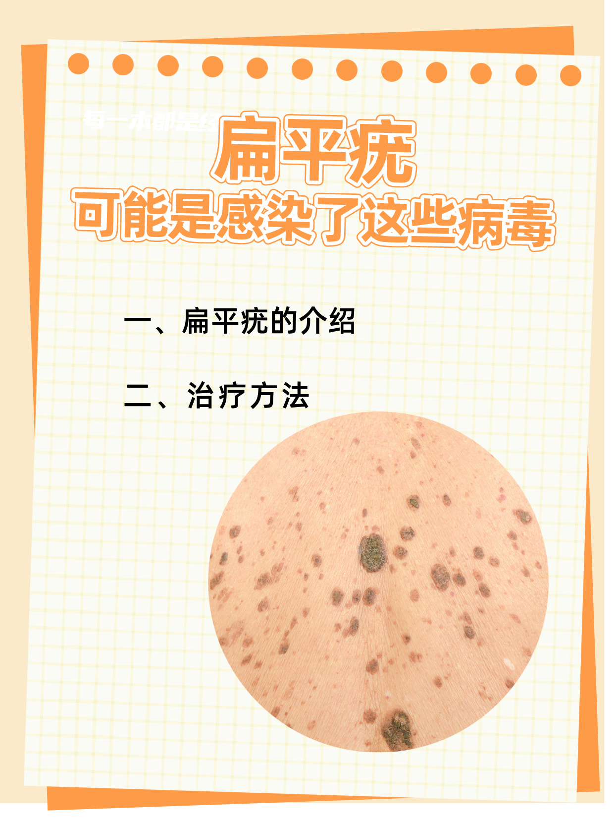 为什么会长扁平疣 为什么会长扁平疣