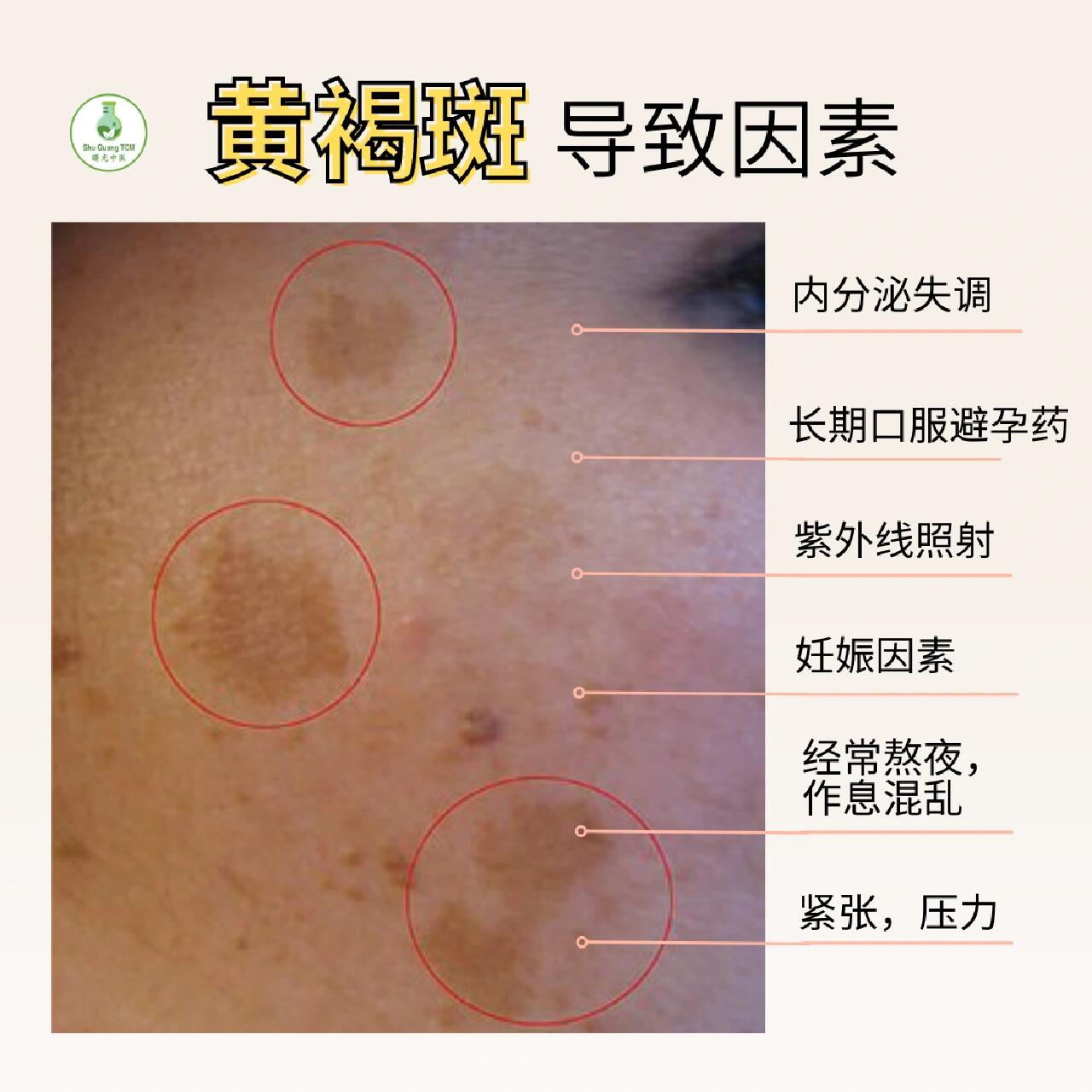 狗狗皮肤为什么会变黑为什么在线 狗狗皮肤为什么会变黑为什么在线