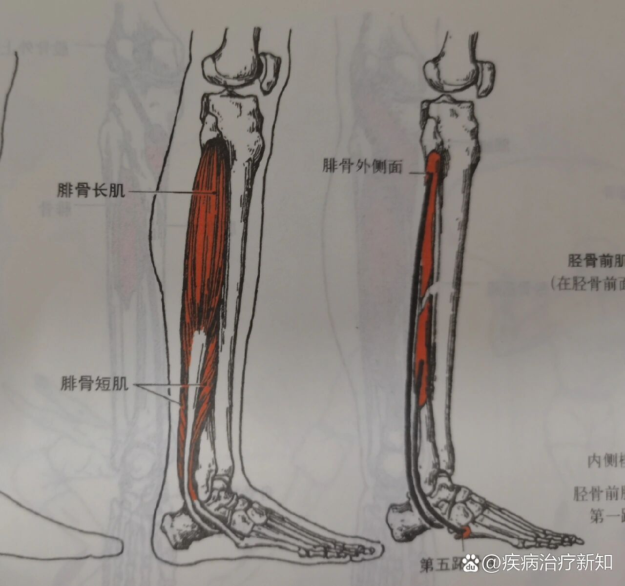 第三腓骨肌图片