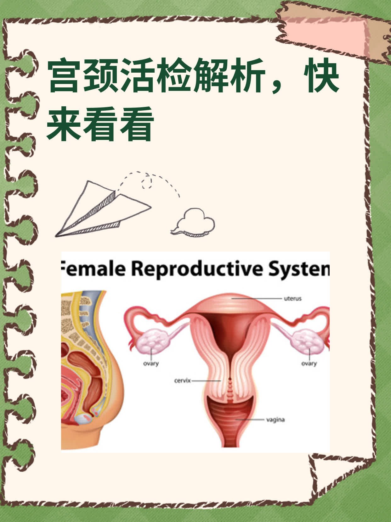 宫颈活检解析,快来看看