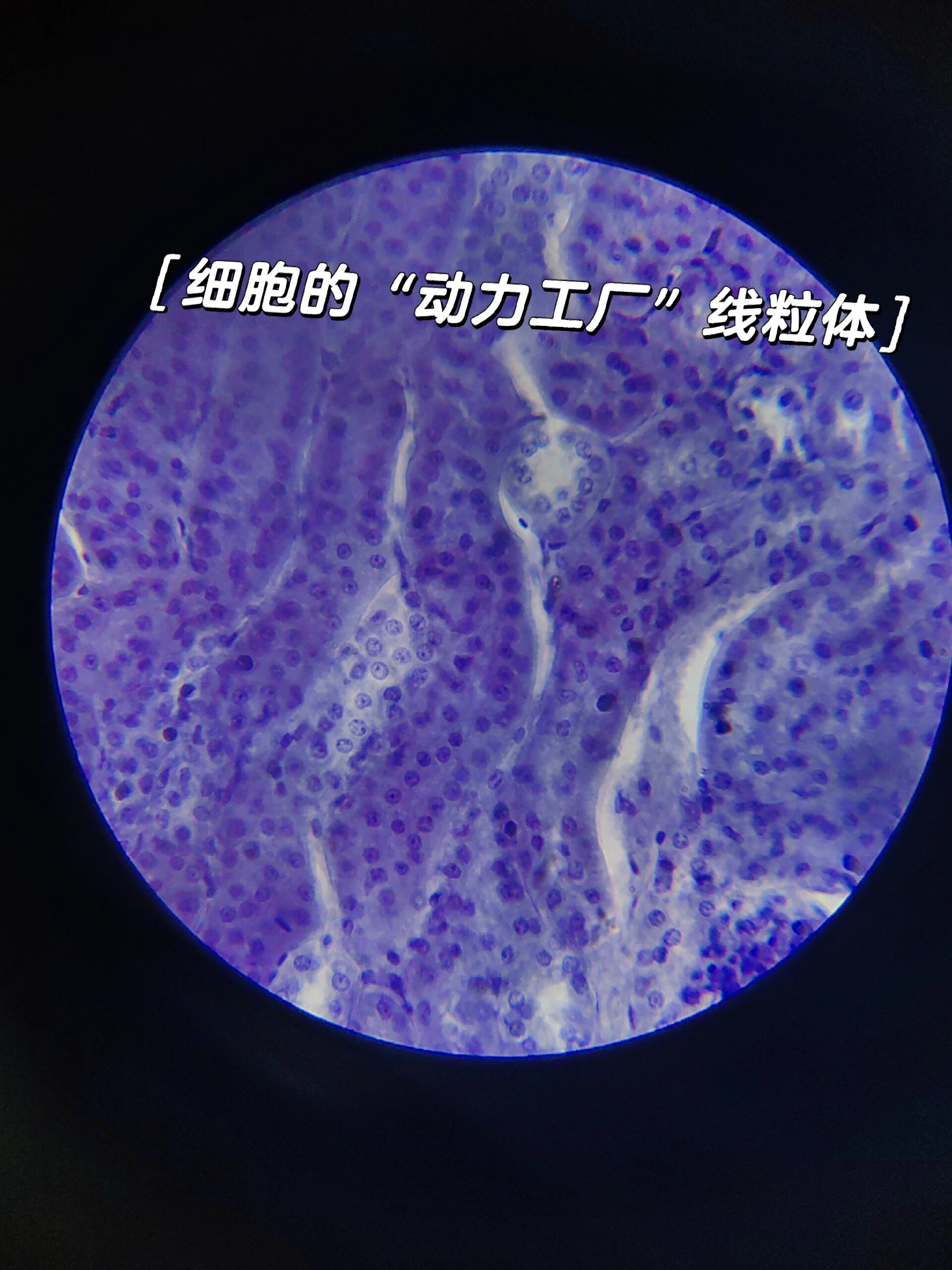 线粒体的超微病理结构
