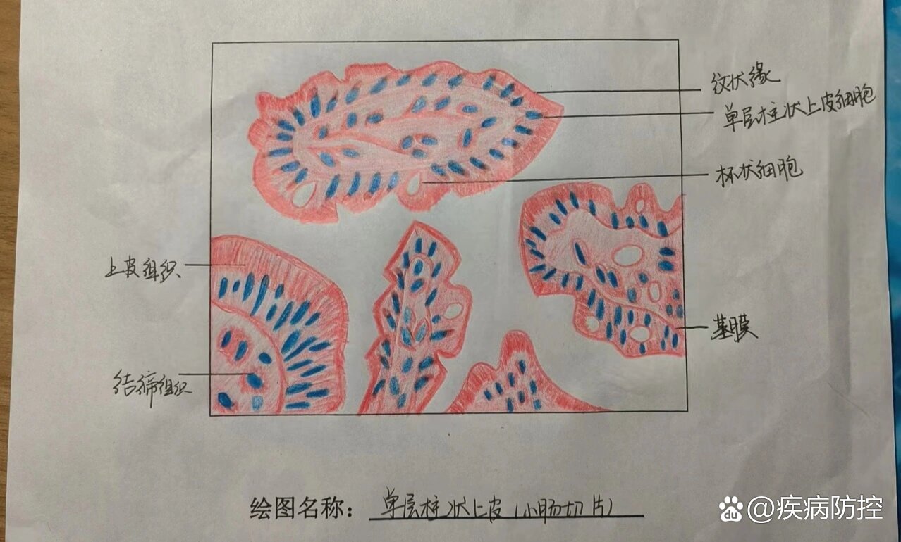 小肠切片图手绘图图片