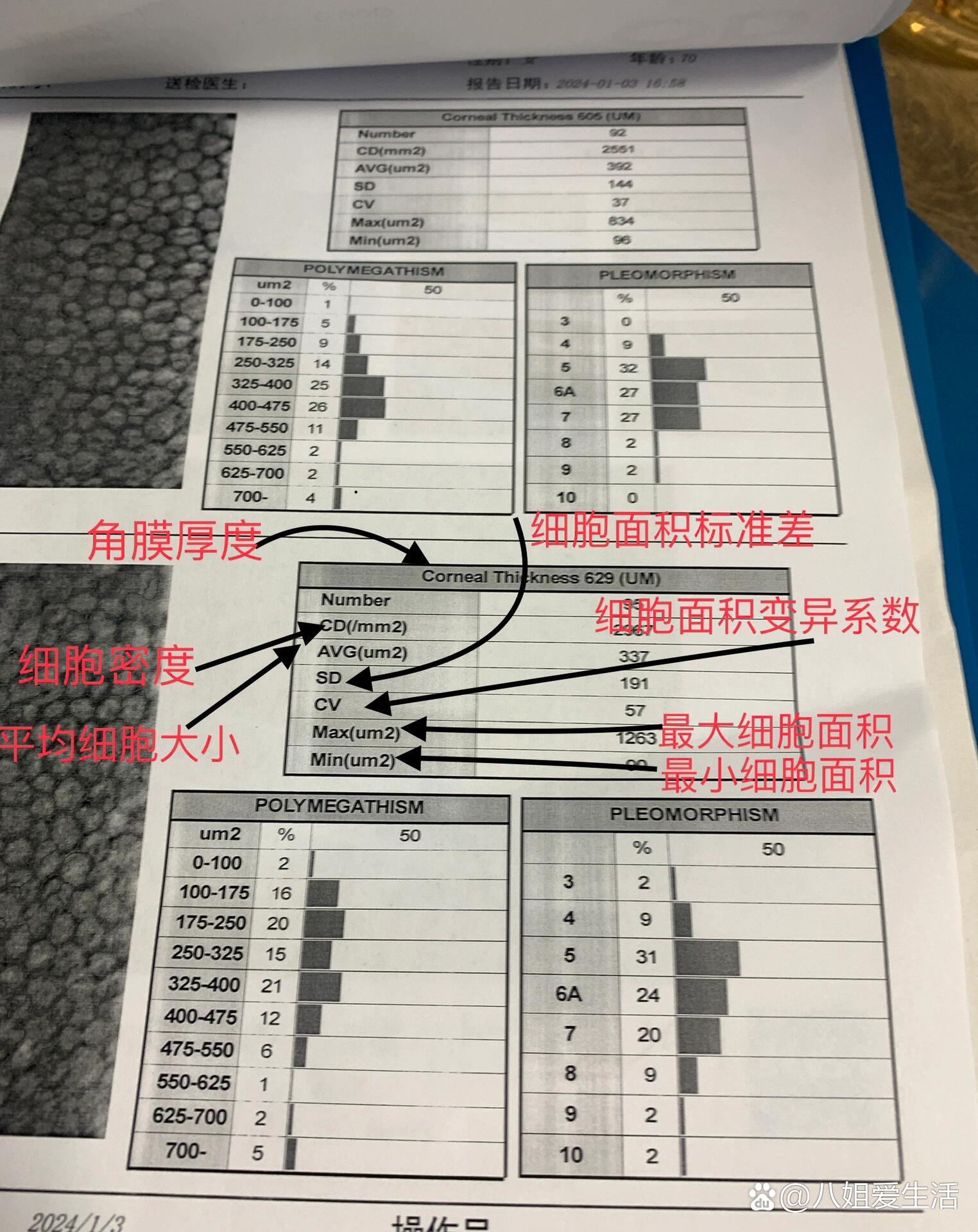 角膜内皮细胞计数图片