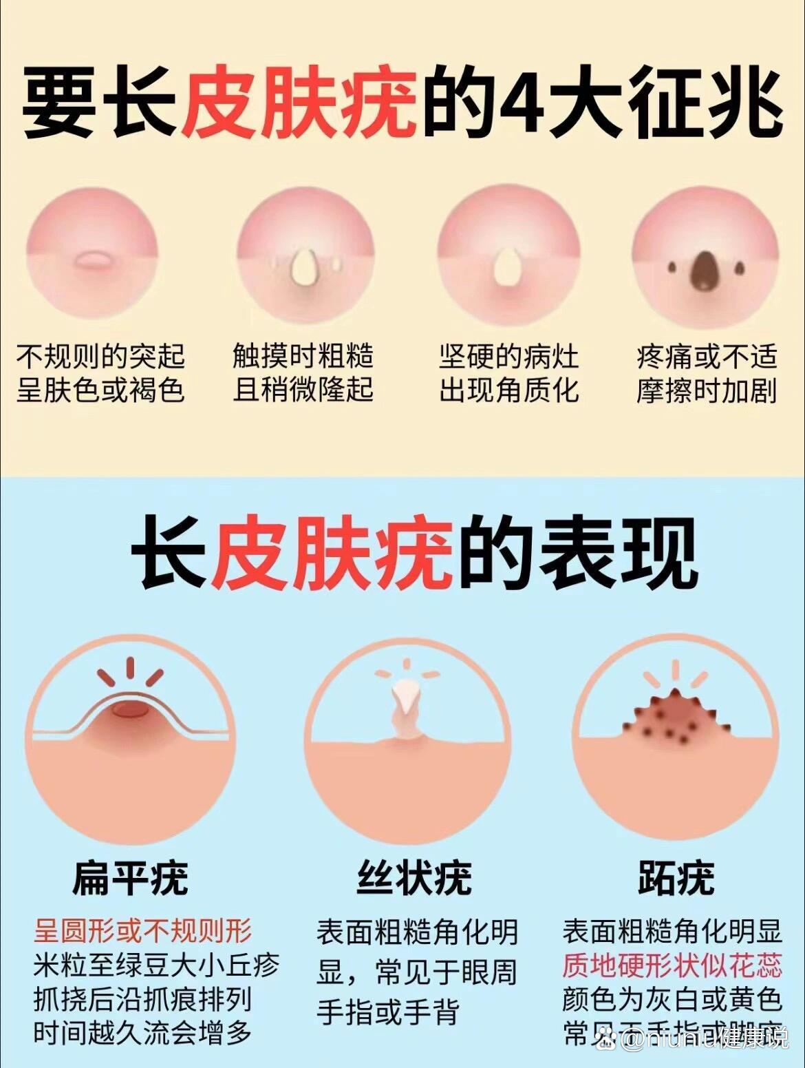 扁平疣不是单纯的皮肤06