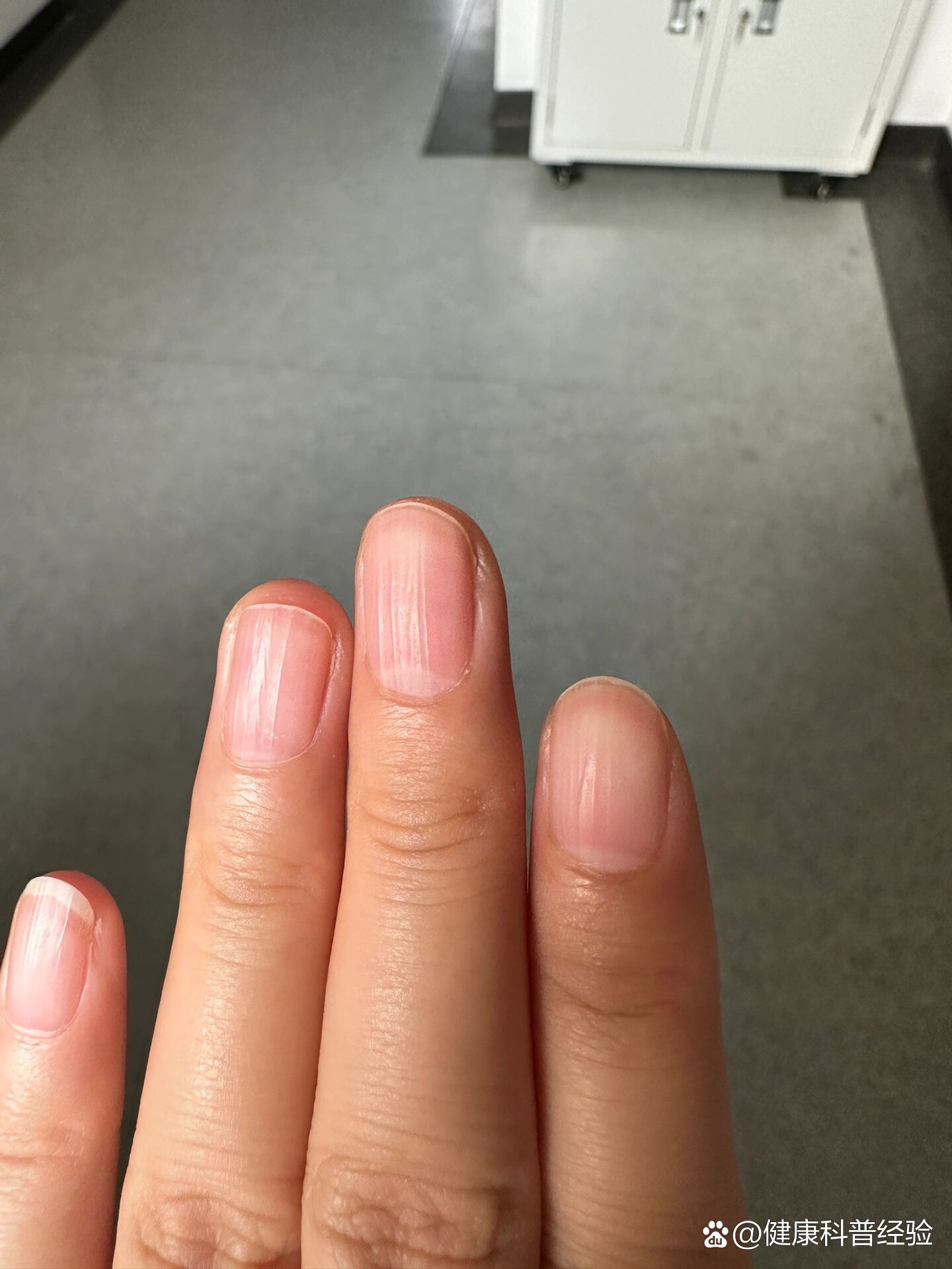 指甲上一条条的棱是什么回事呀