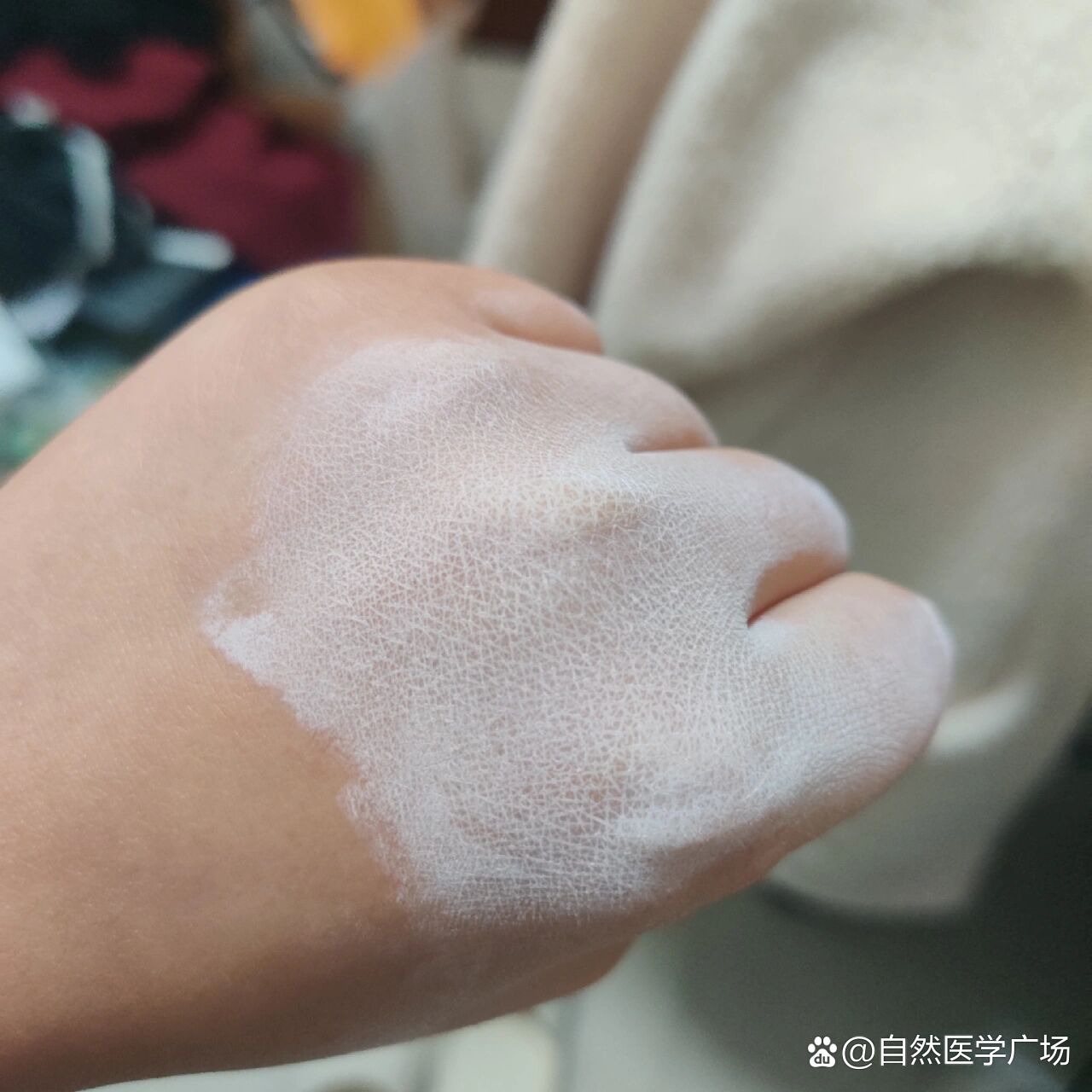 皮肤过敏用炉甘石洗剂真的很好用!