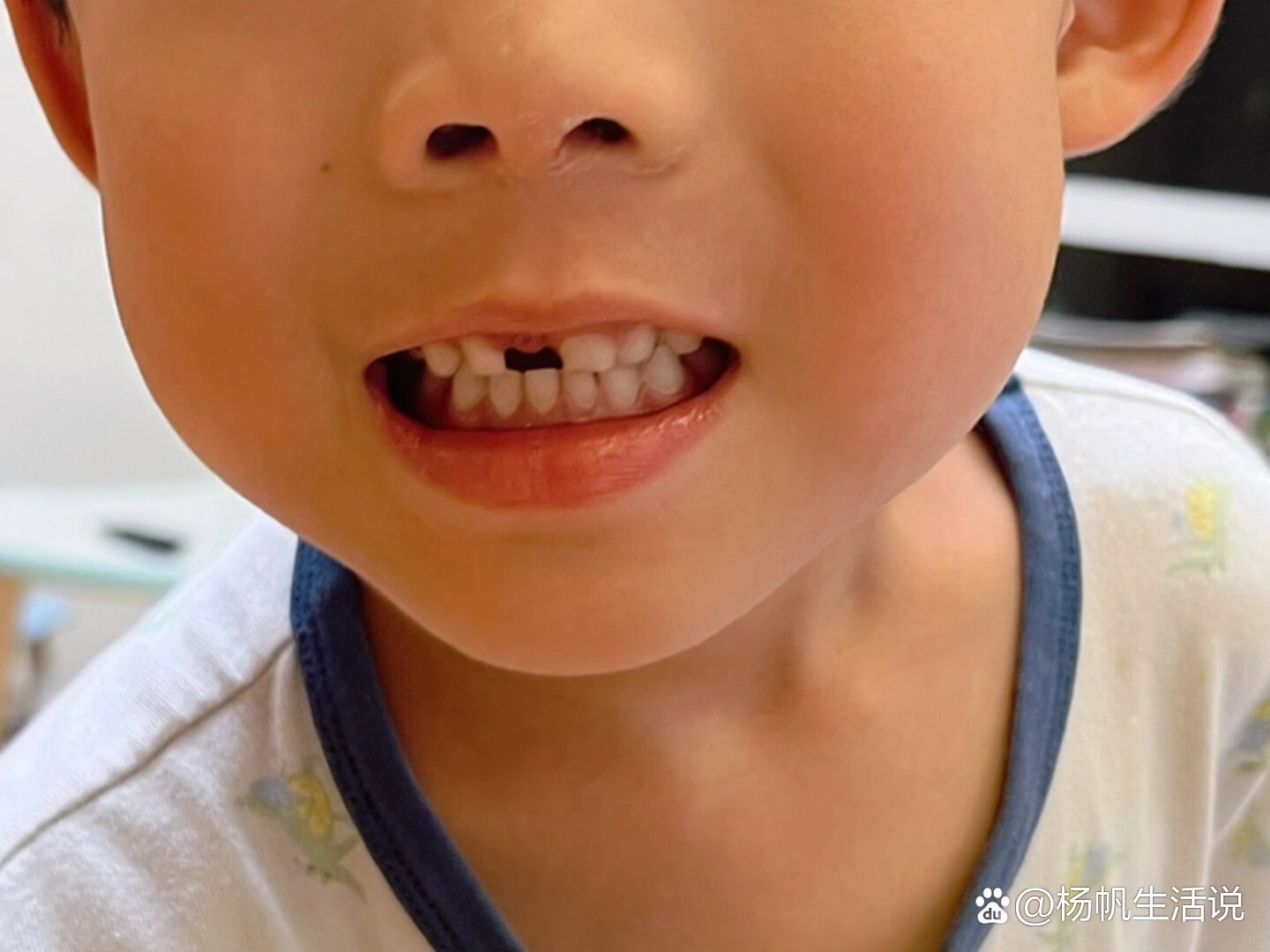 四岁半的缺牙宝宝上线了
