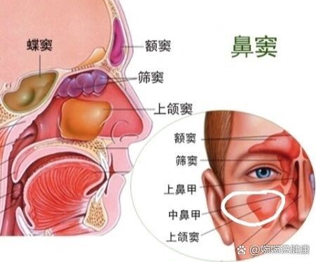 真菌性鼻窦炎手术经历