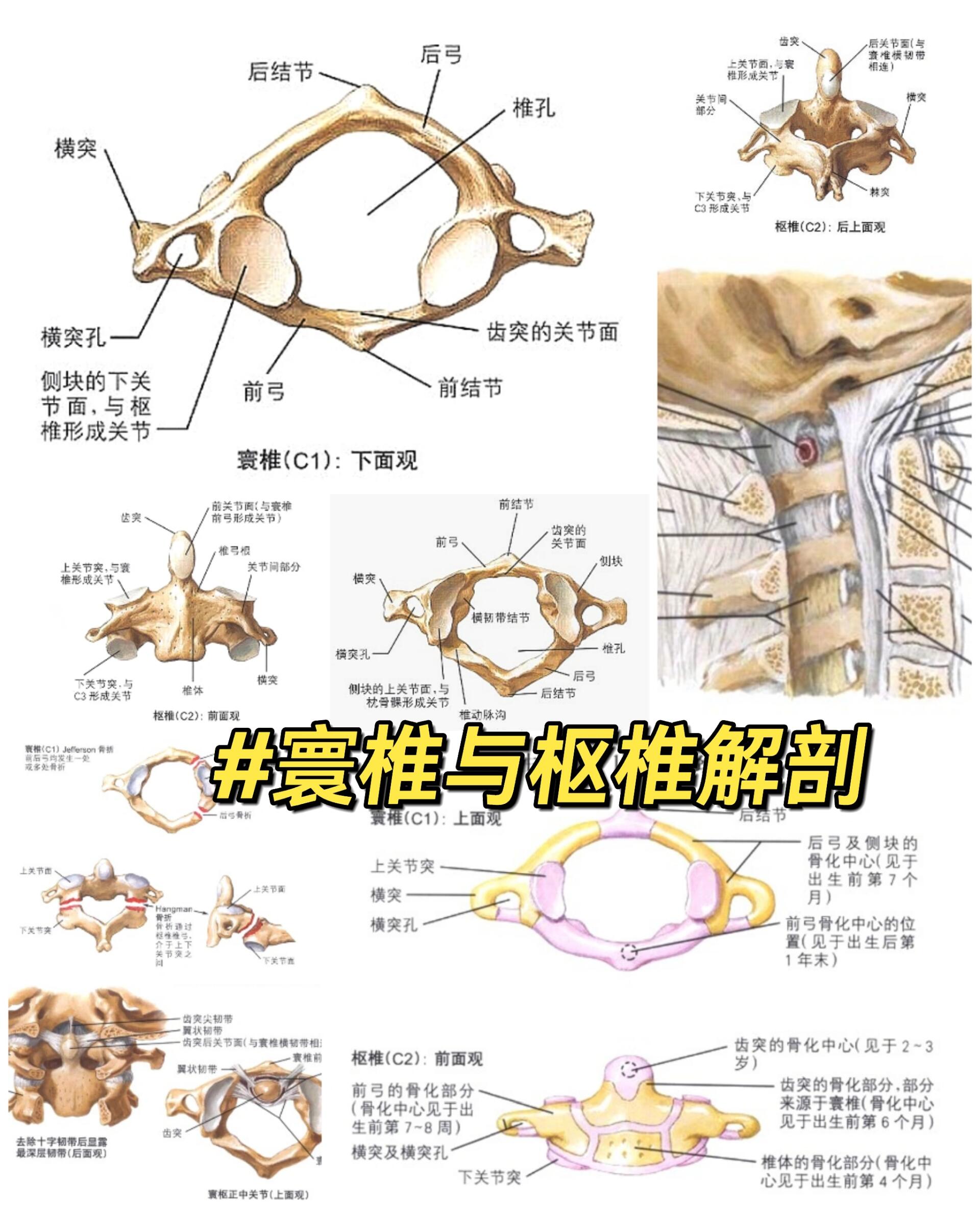 寰椎和枢椎解剖图手绘图片