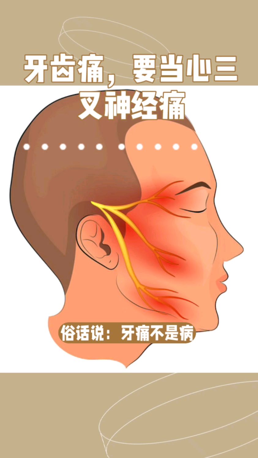 三叉神经的位置图片