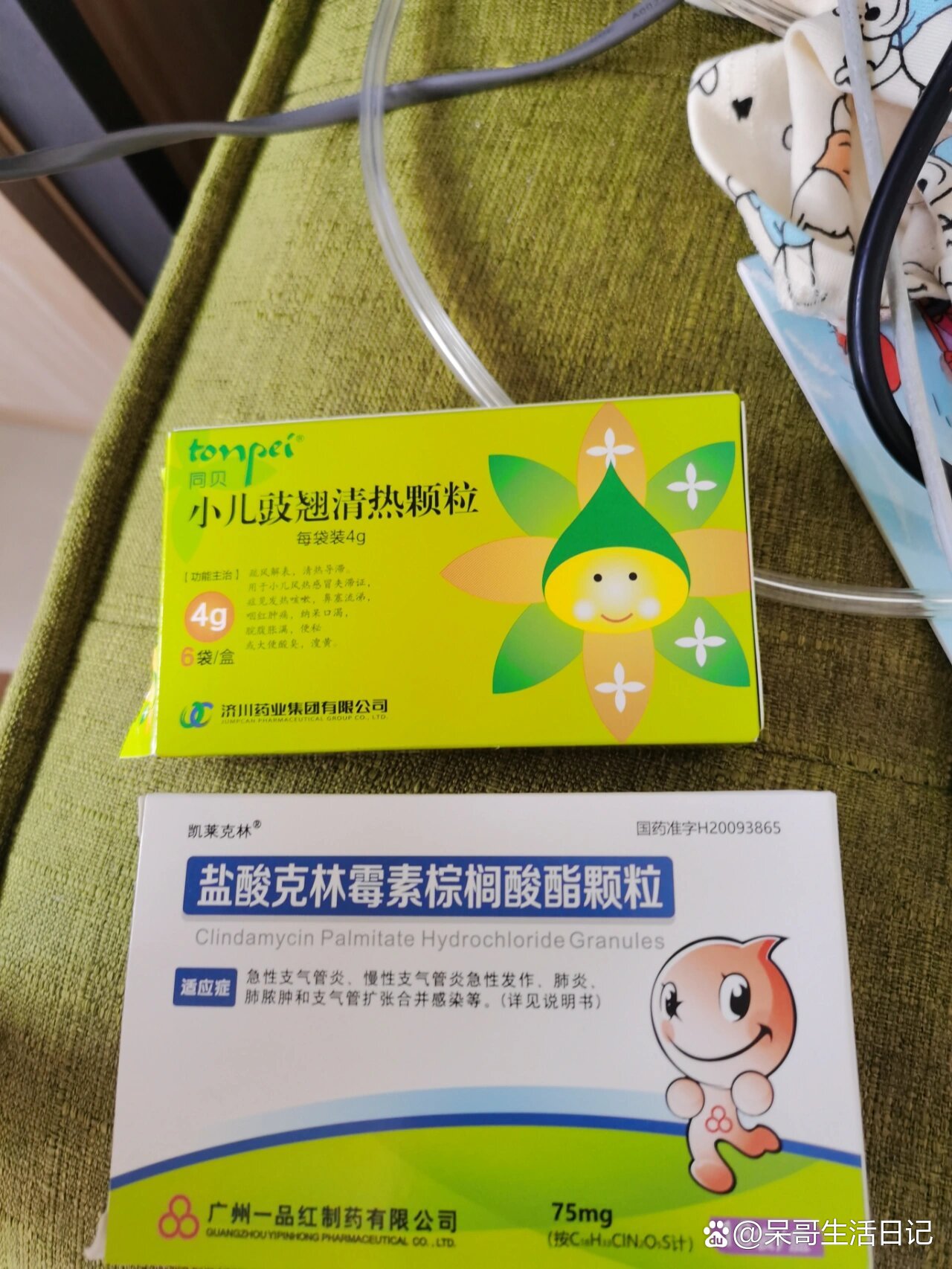 急性腮腺炎