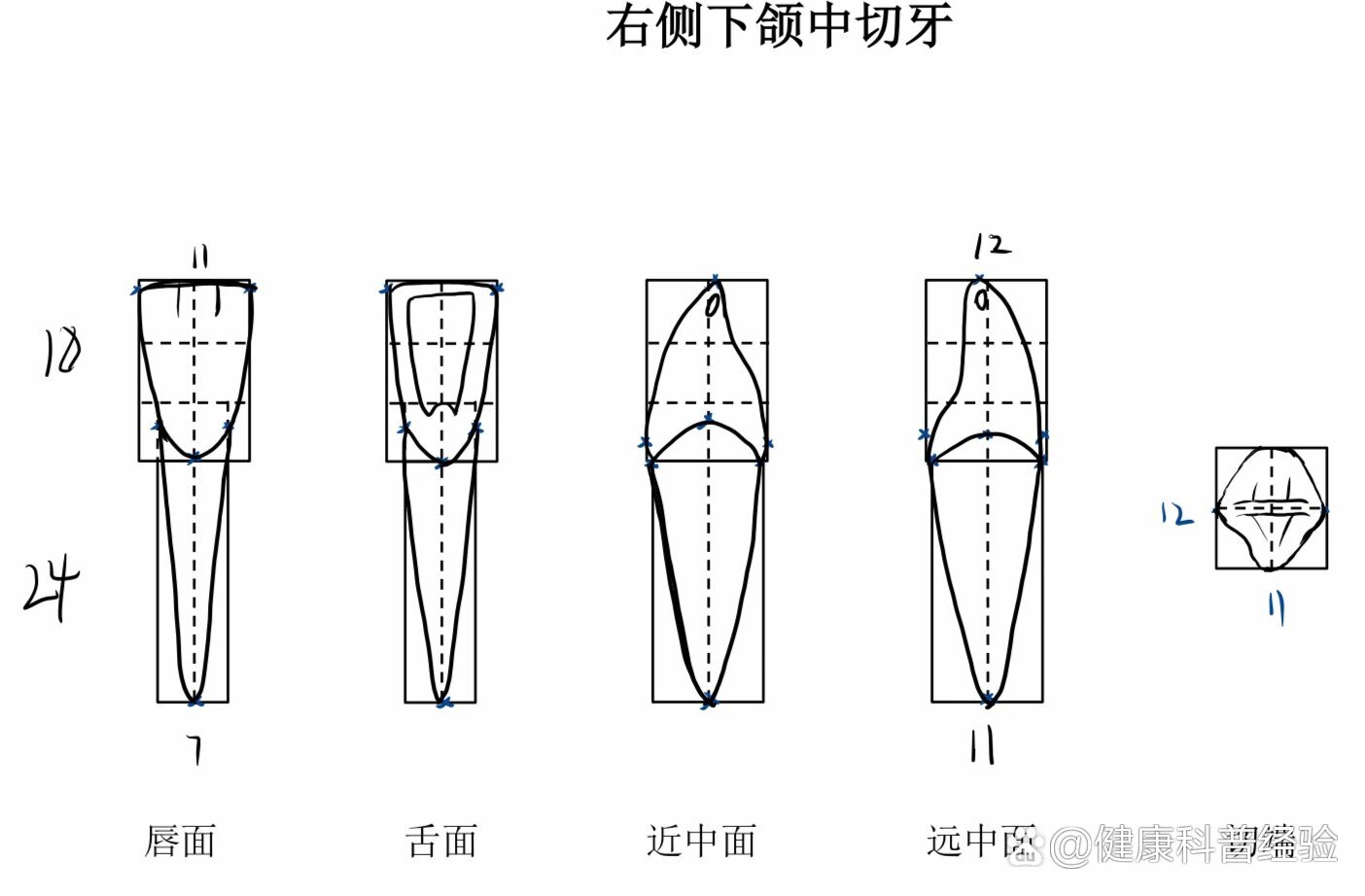 下颌中切牙缺失图片