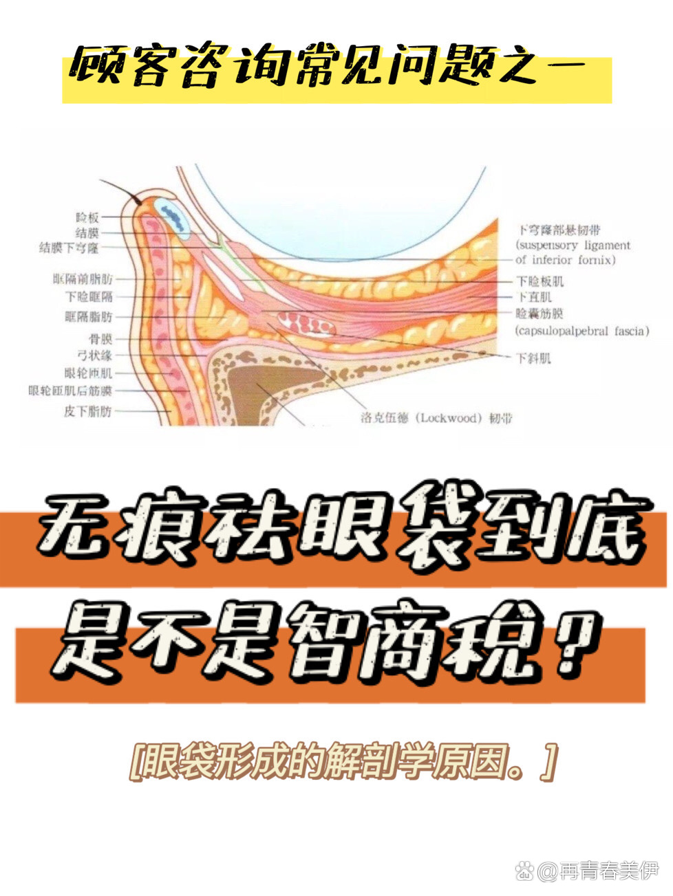 眼袋结构图并带名称图图片