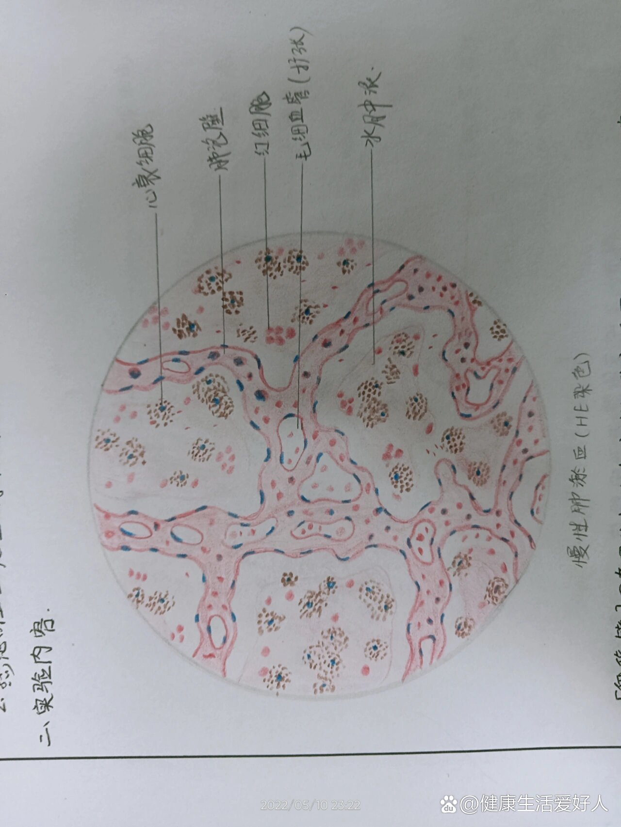 伤寒红蓝铅笔图图片