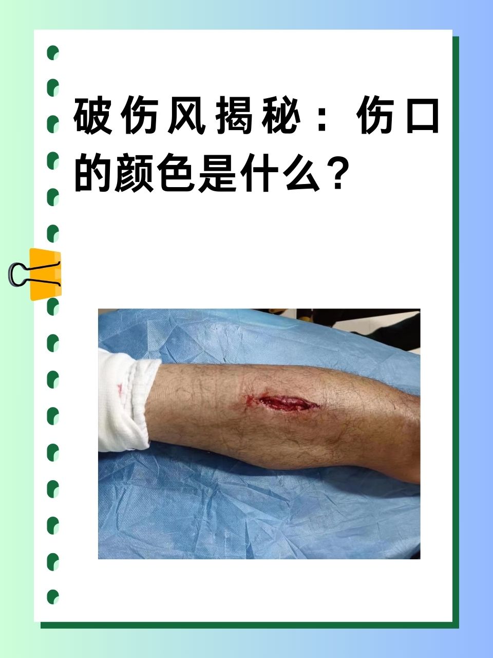 破伤风揭秘:伤口的颜色是什么?