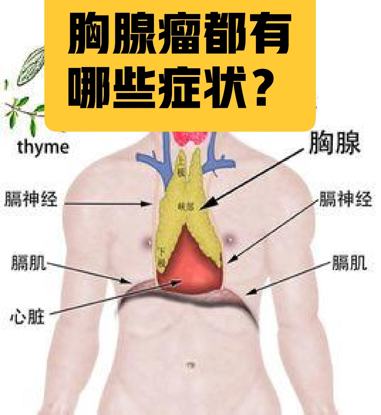 胸上长肿瘤图片图片