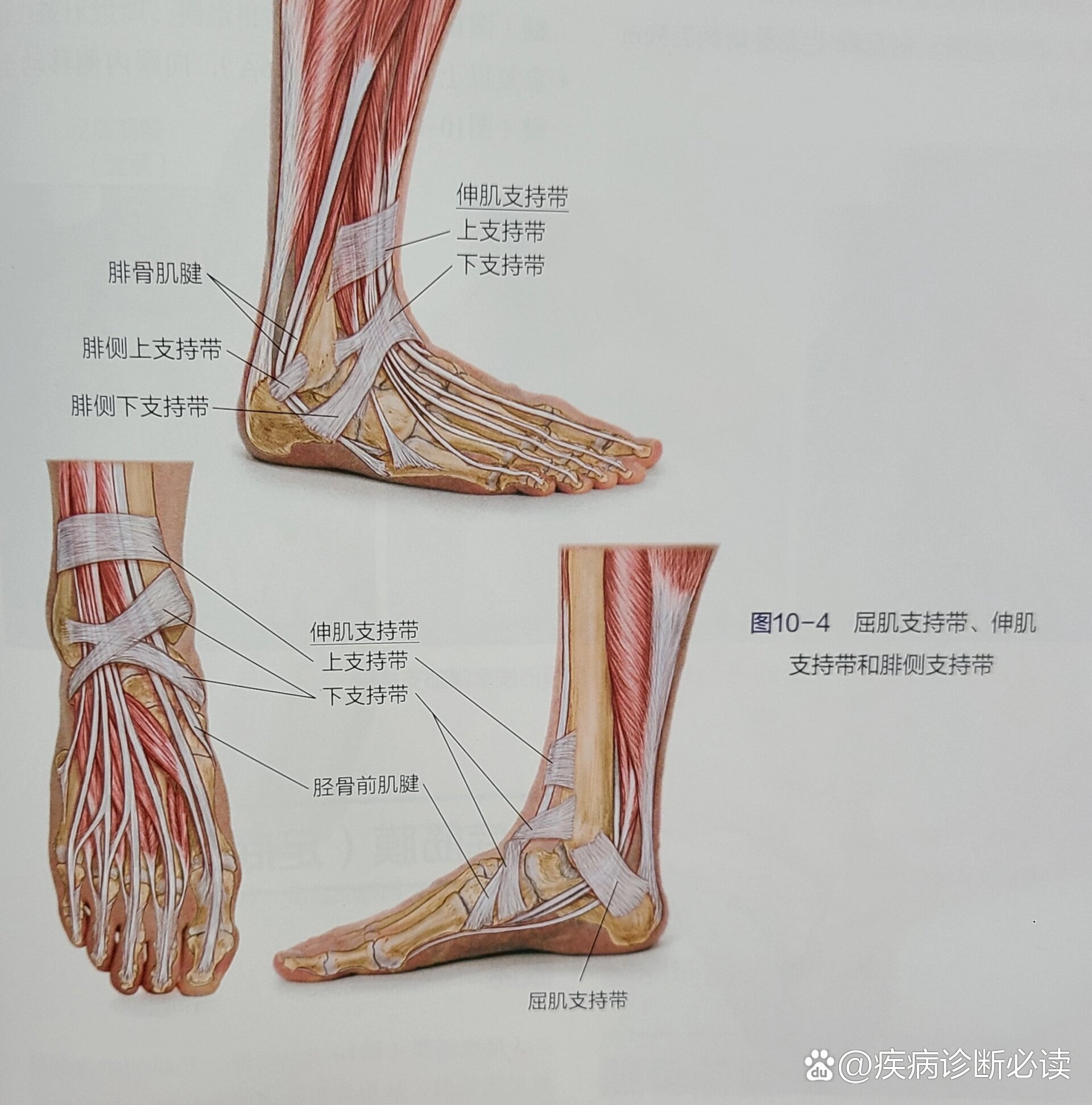 足踝支持带松解