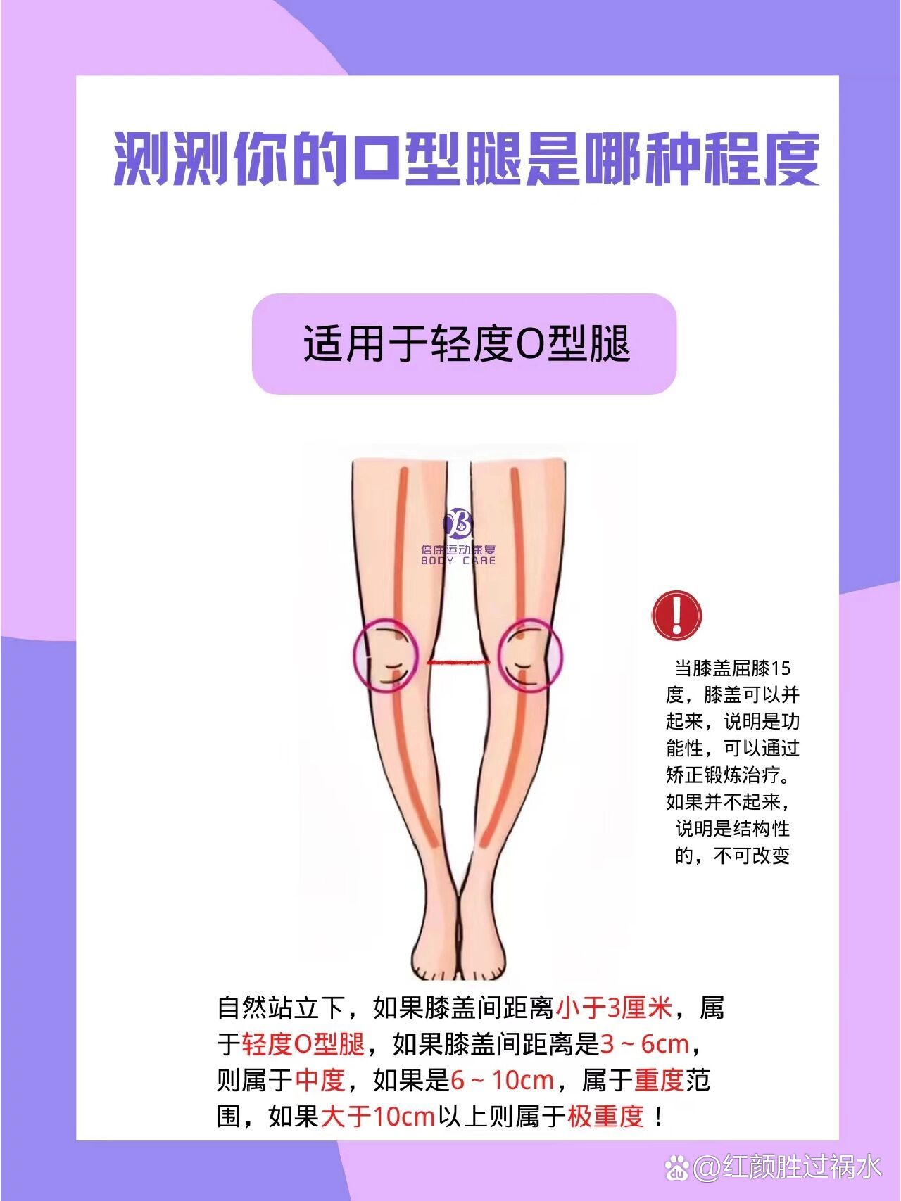 5个动作矫正o型腿