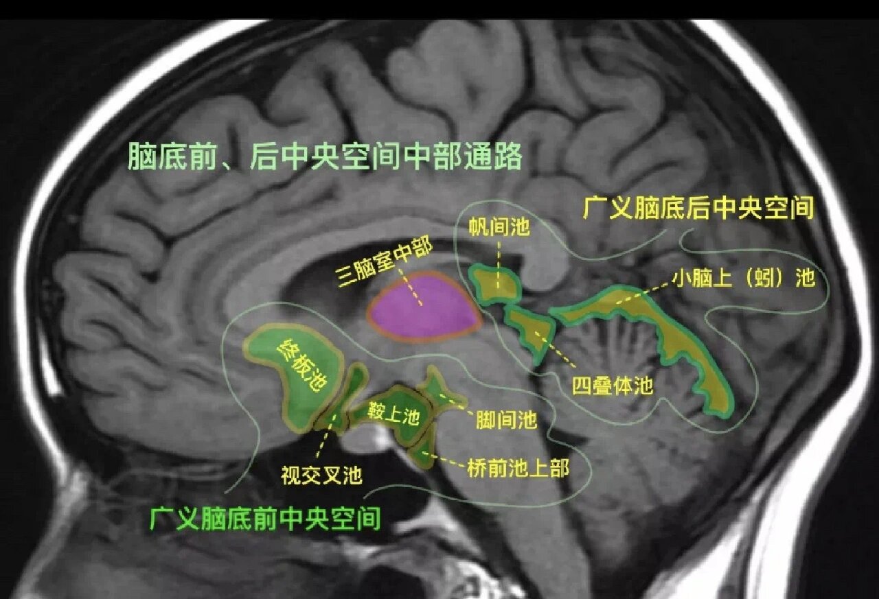 脑部矢状位解剖图图片