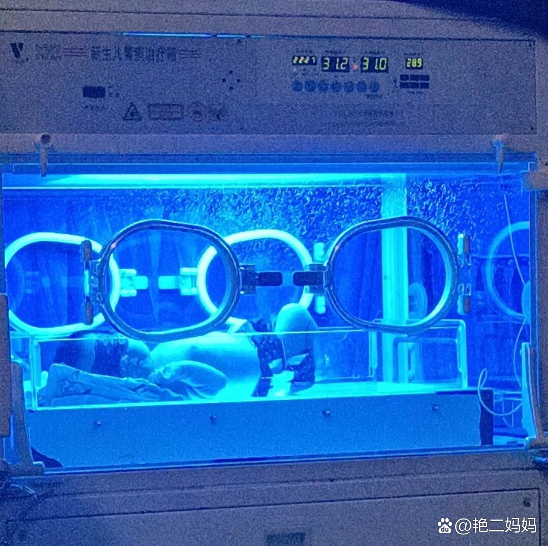 新生儿宝宝黄疸被迫住保温箱