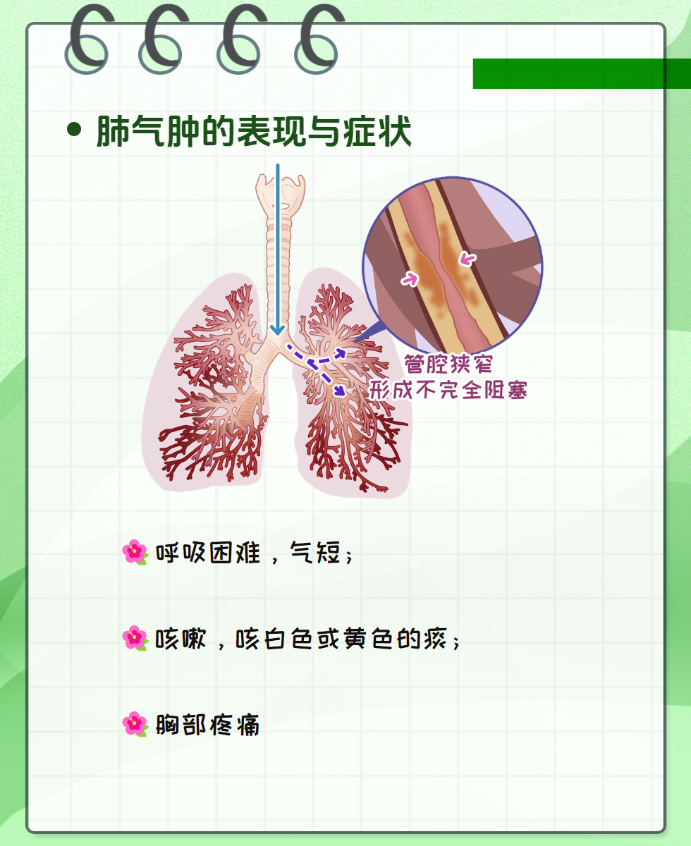 肺气肿的四大体征 全网资源