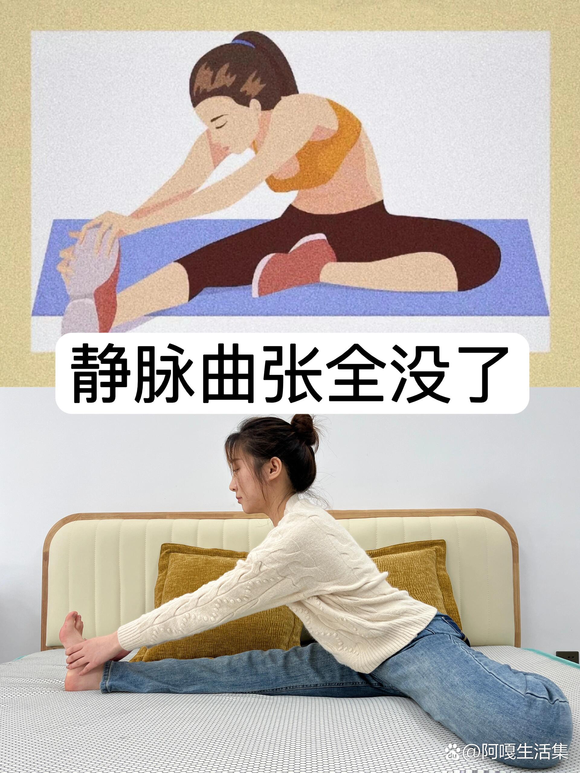 三年静脉曲张,我真快成半个行家了