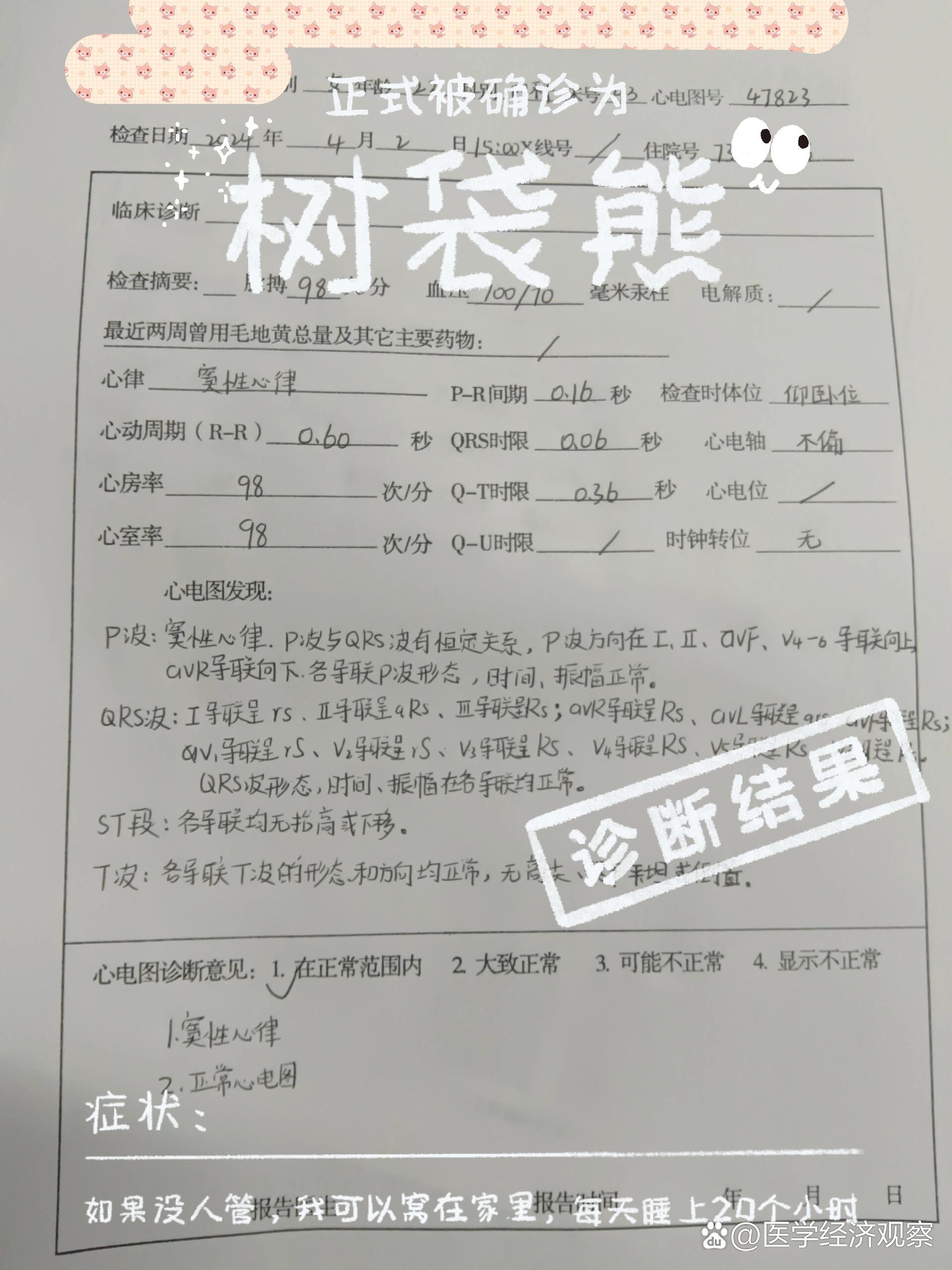 正常心电图报告