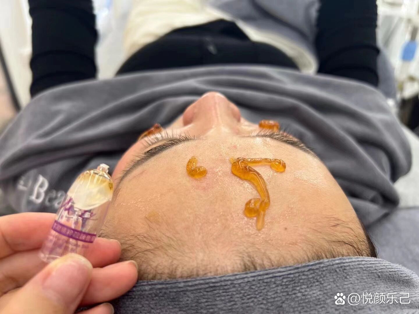 后来看到朱燕老师的皮肤越来越好,就果断选择诺琦格到现在牵手诺琦格