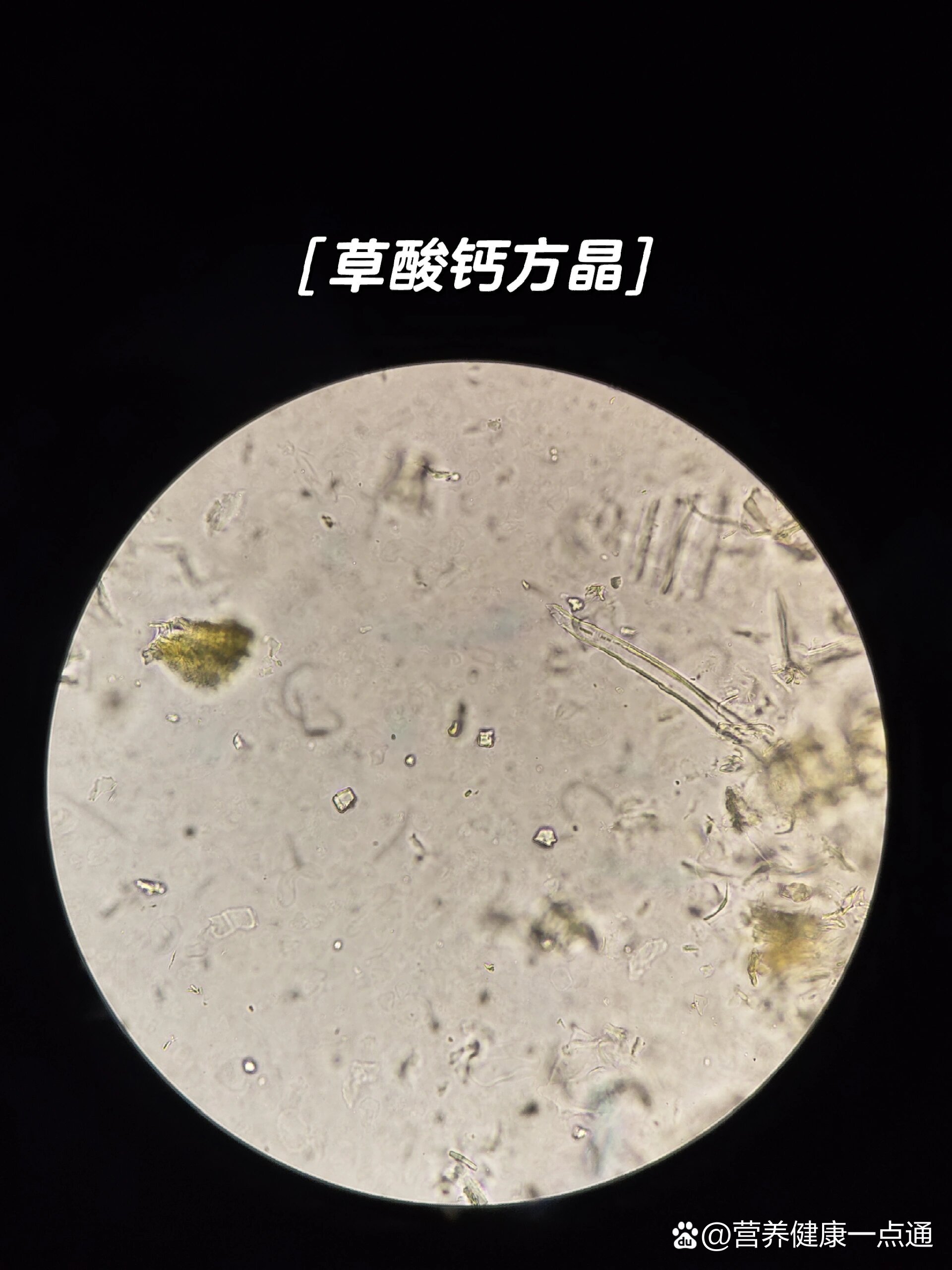 甘草粉末显微图