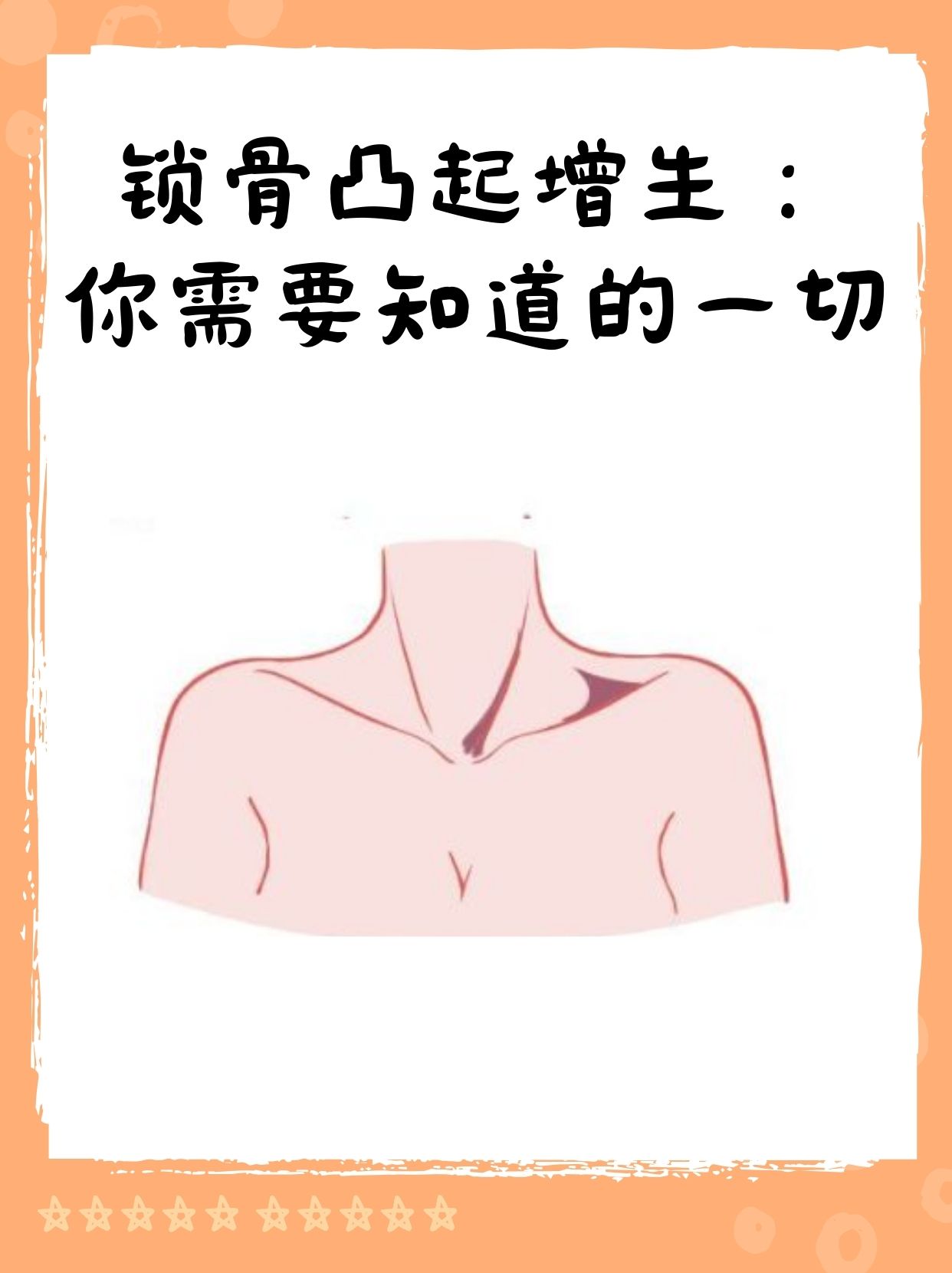 锁骨凸起增生不仅影响美观,还可能引发疼痛